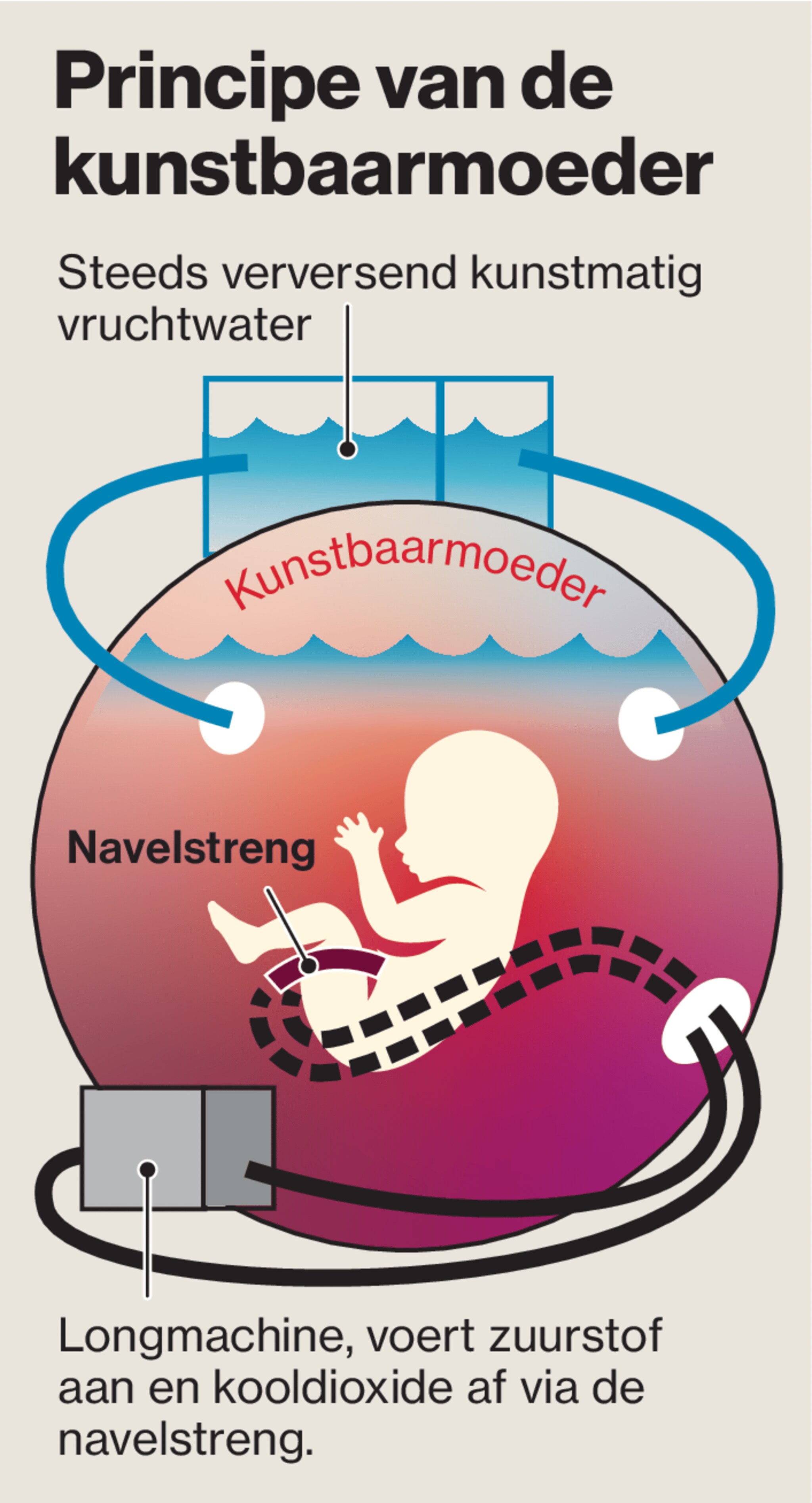 kunstbaarmoeder premature baby