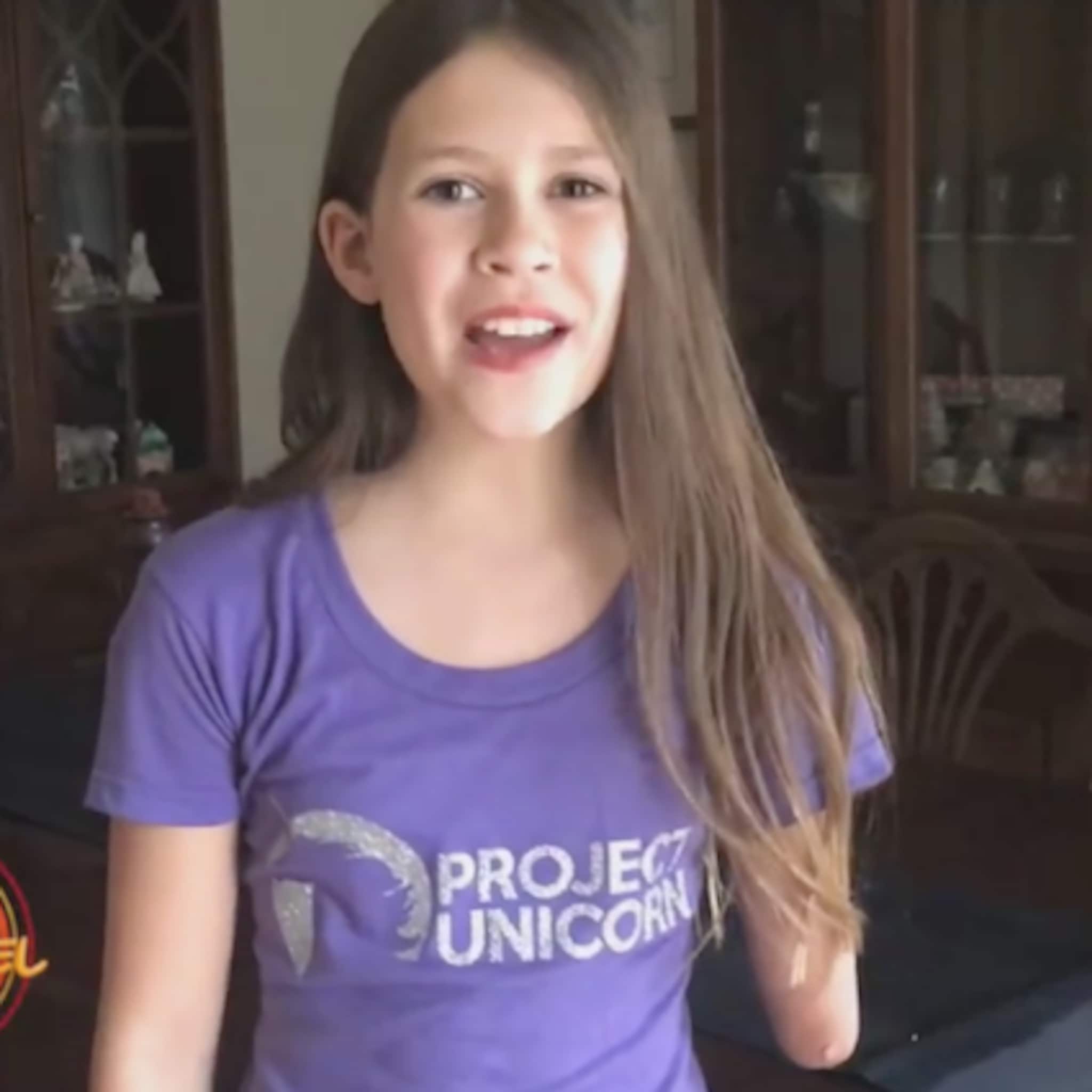 geweldig meisje ontwerpt prothese arm die glitters schiet