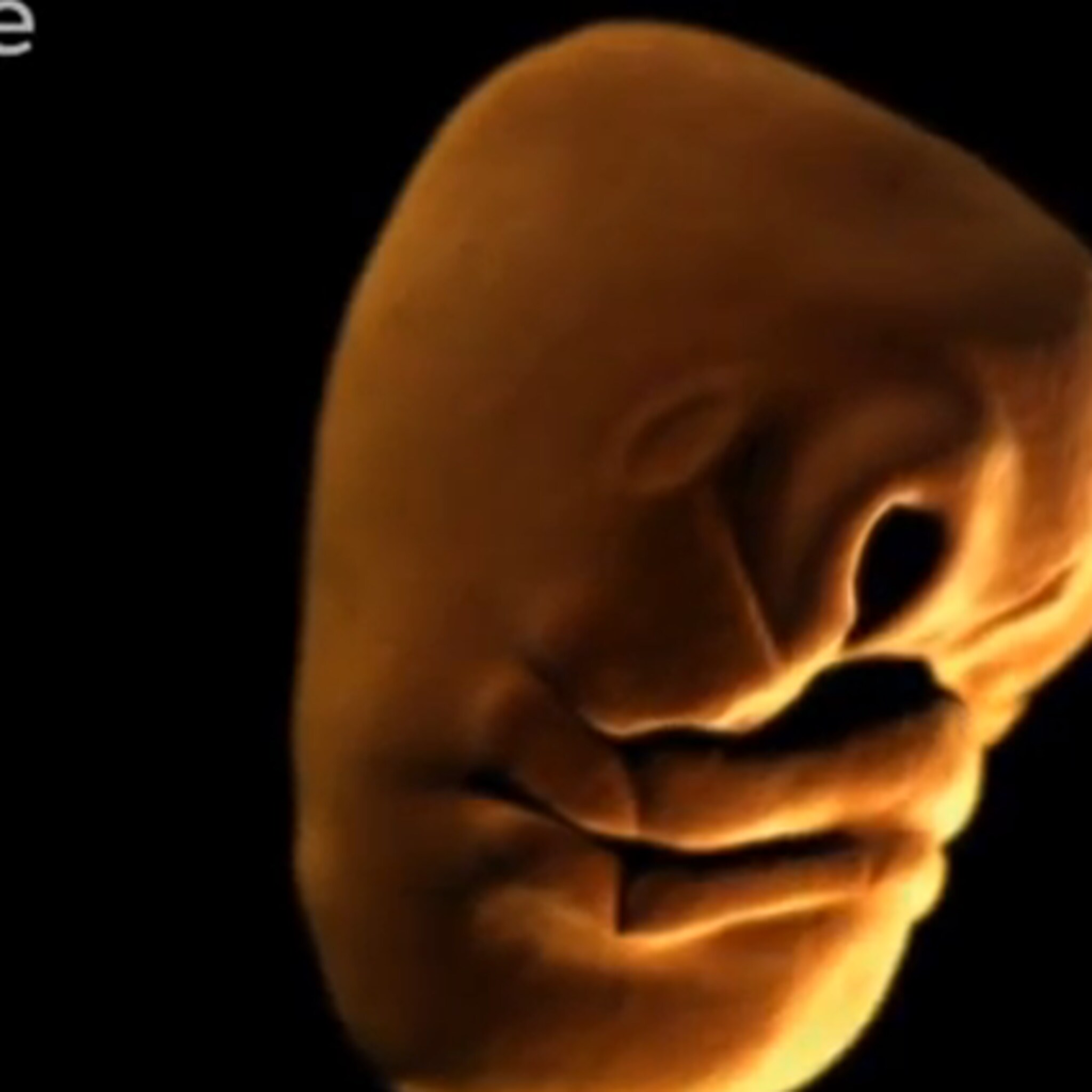zo ontwikkelt het gezicht van een baby zich in baarmoeder