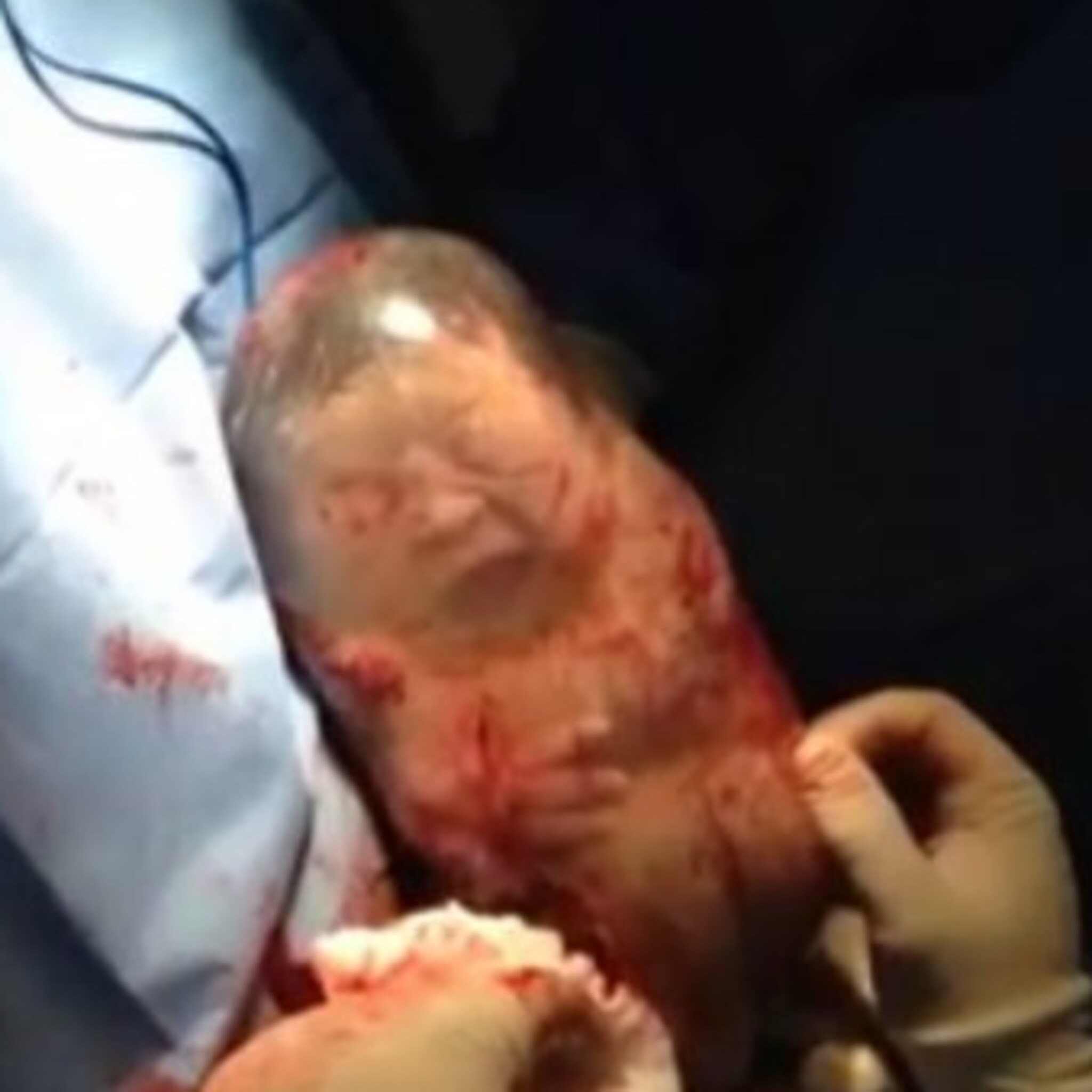 baby geboren in vruchtzak