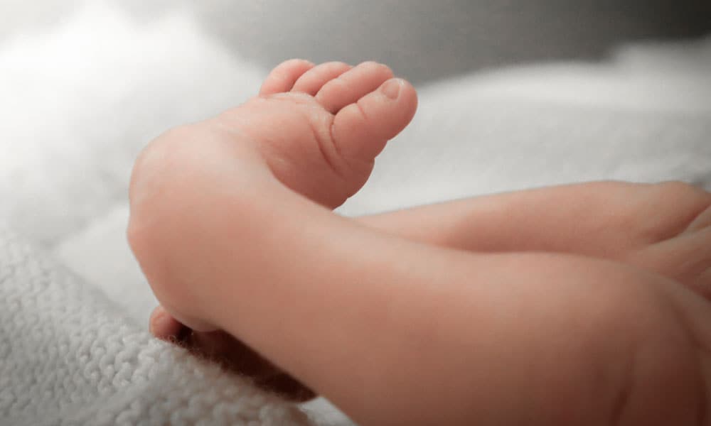 Klompvoet bij je baby Getty Images