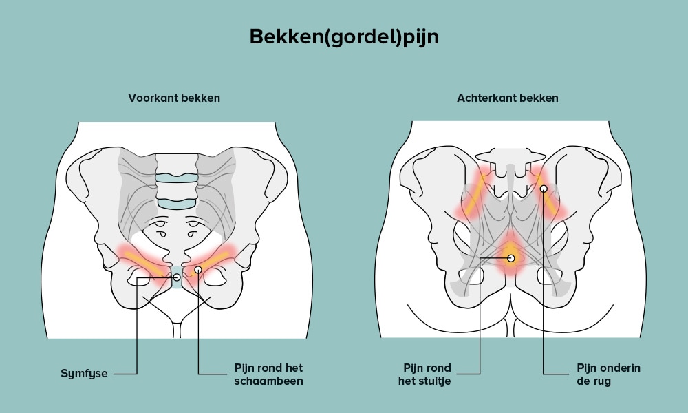 Bekkenpijn Ouders van Nu Redactie