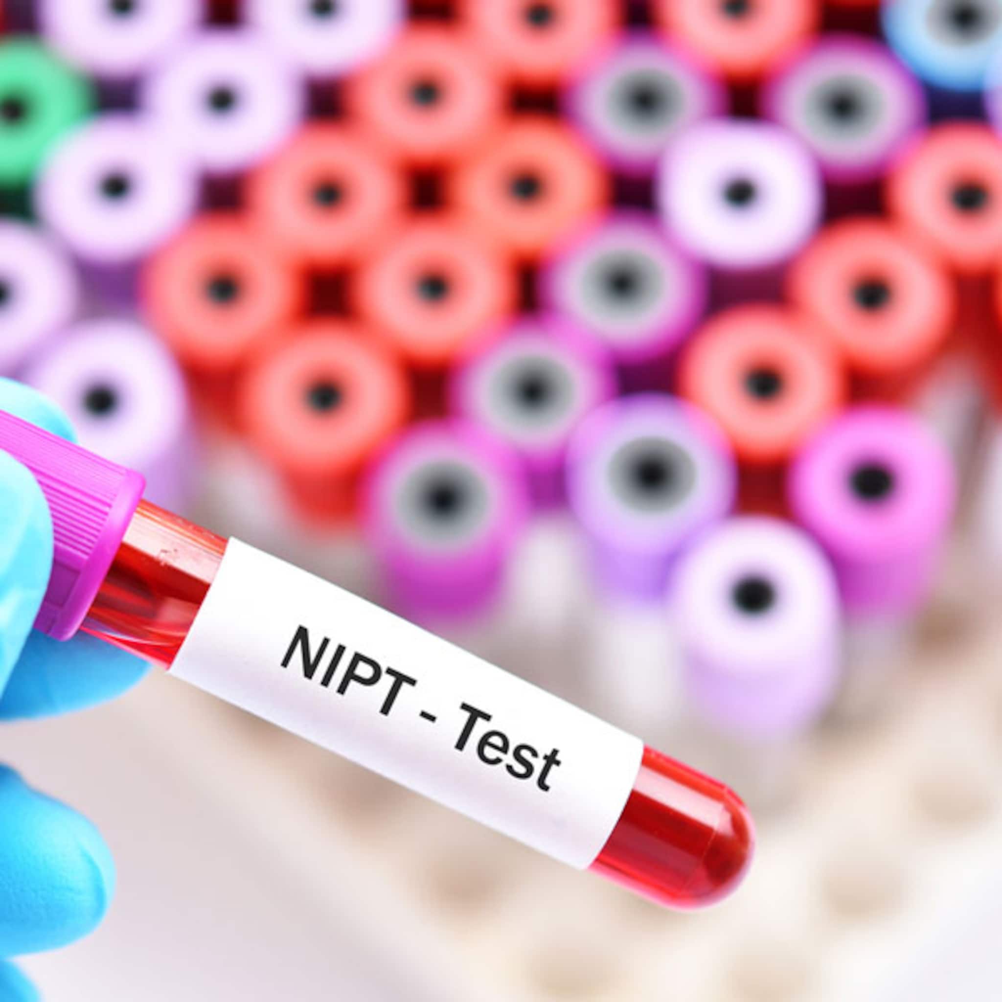 nipt-de-niet-invasieve-prenatale-test