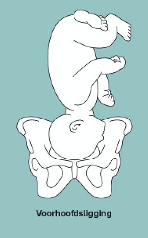 Ligging van je baby in de buik Ouders van Nu Redactie