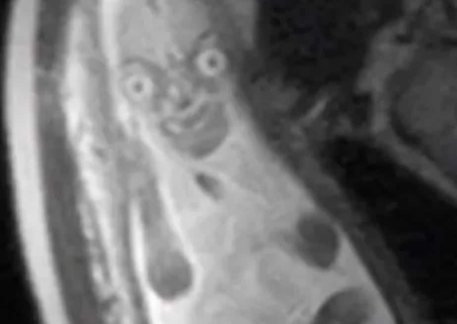 Dit is waarom je een echo van je baby krijgt, en geen MRI-scan Ouders van Nu Redactie