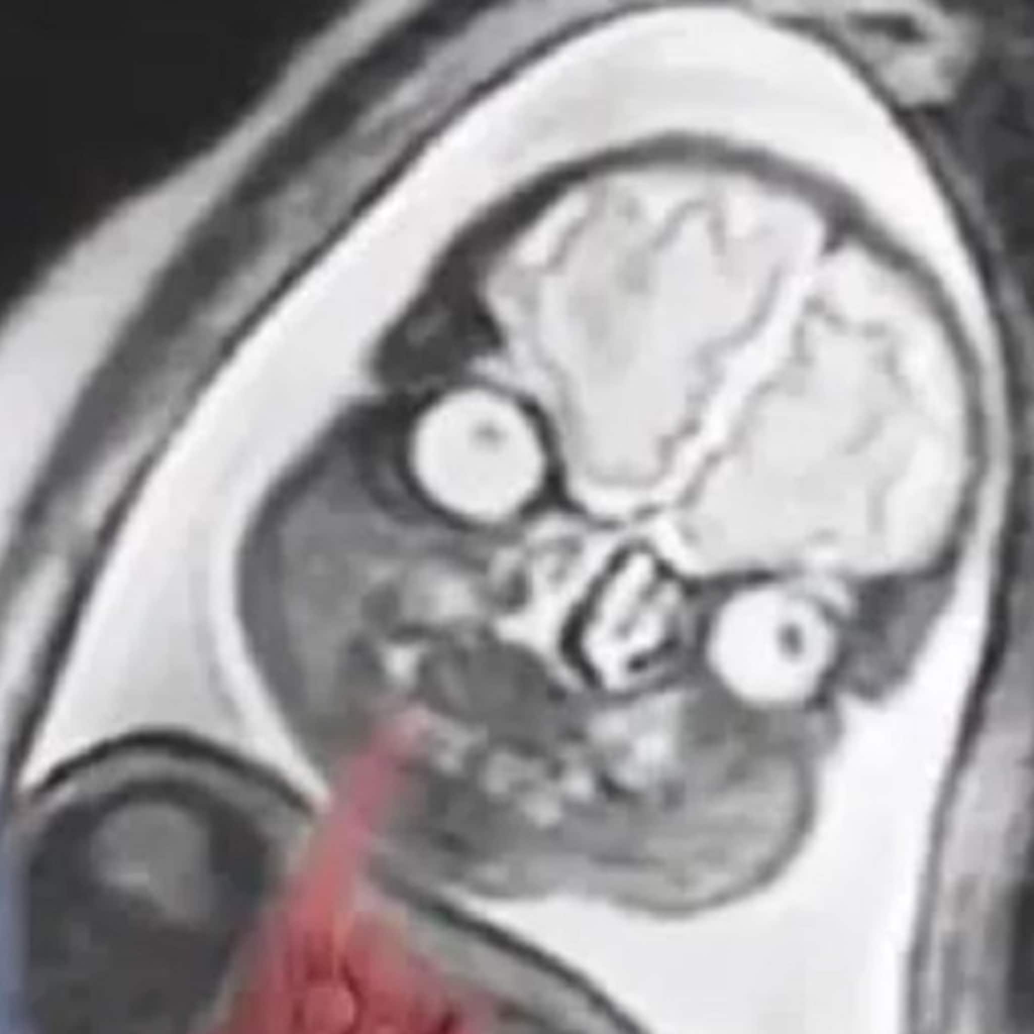 dit is waarom je een echo van je baby krijgt en geen mri scan