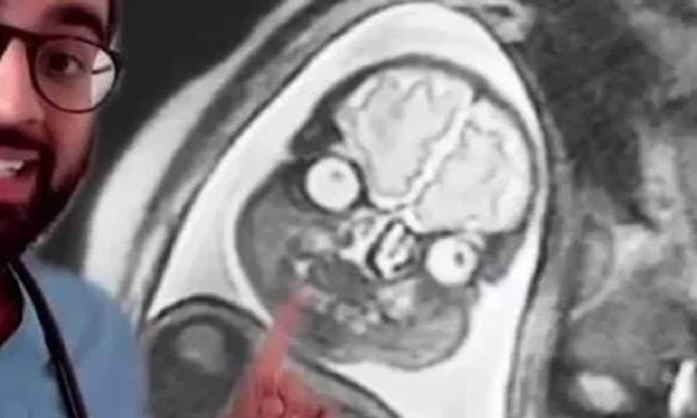 Dit is waarom je een echo van je baby krijgt, en geen MRI-scan Ouders van Nu Redactie