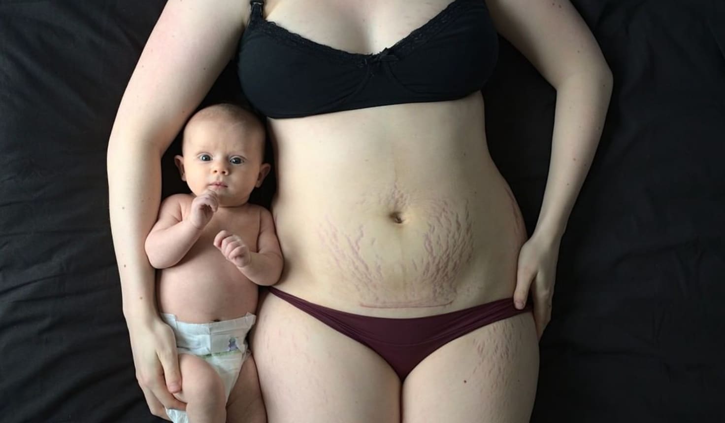 Prachtige fotoserie: hoe het moederlijf er écht uitziet na de bevalling Ouders van Nu Redactie