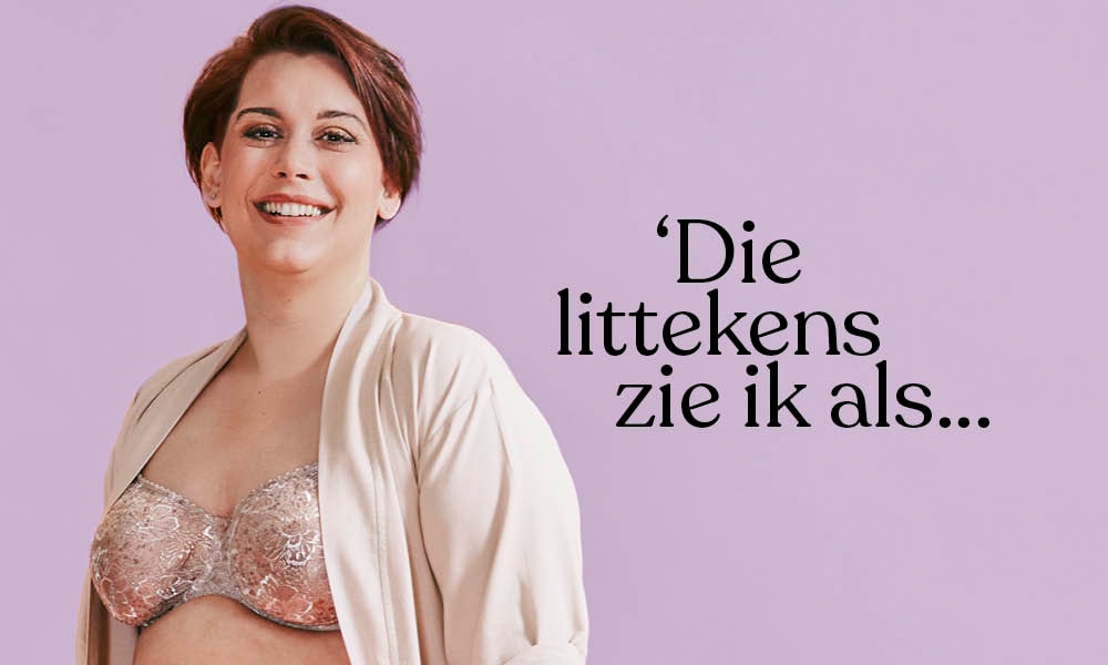 Ingrid: ‘Die littekens zie ik als mijn levenstekening, ik ben er nog’ Ouders van Nu Redactie