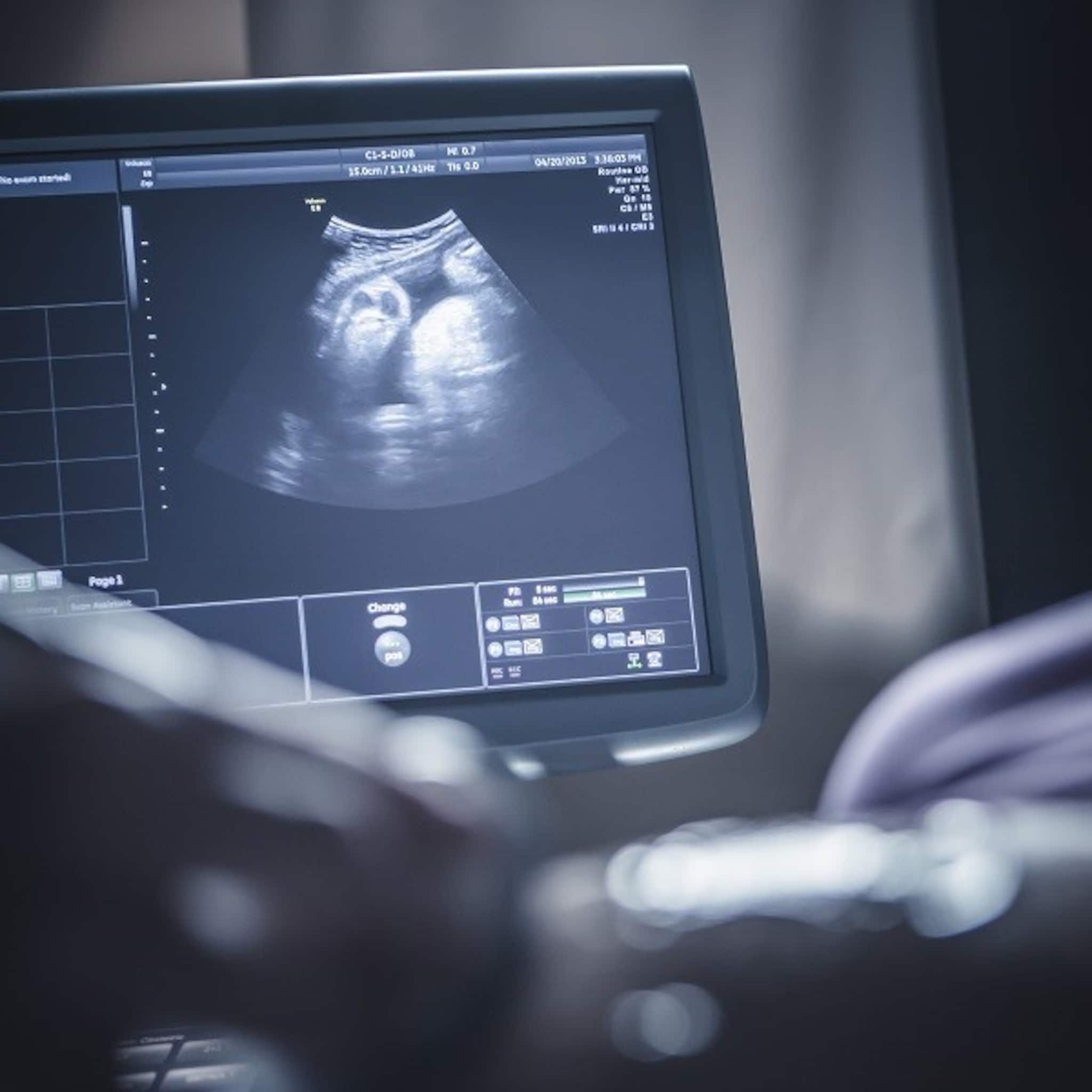 een spermadonor via facebook raar we vonden anders wel de perfecte kandidaat