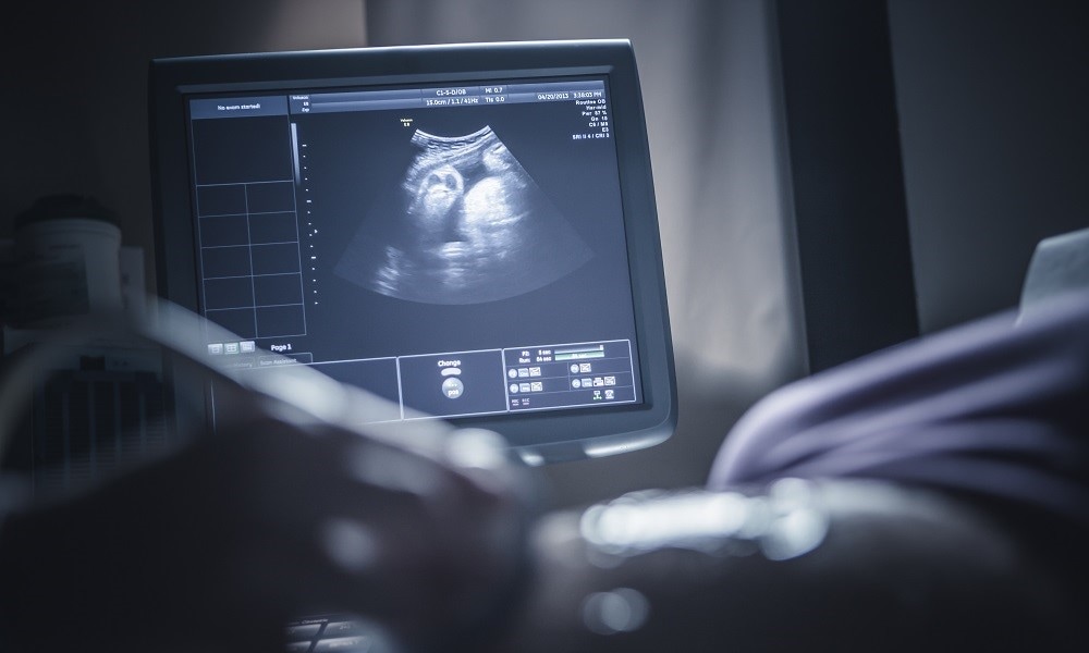 Zwanger van een spermadonor via Facebook Getty Images