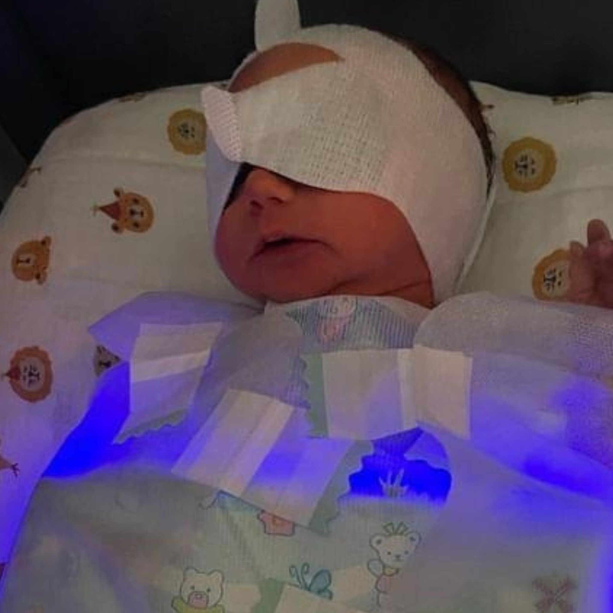 geelzucht behandelen kan ook thuis baby lucas lag in een cocon met blauw licht