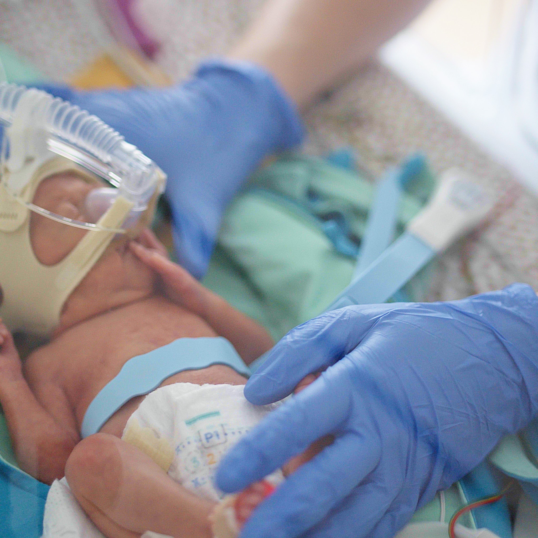 primeur geen elektrodes op premature baby maar draadloze band