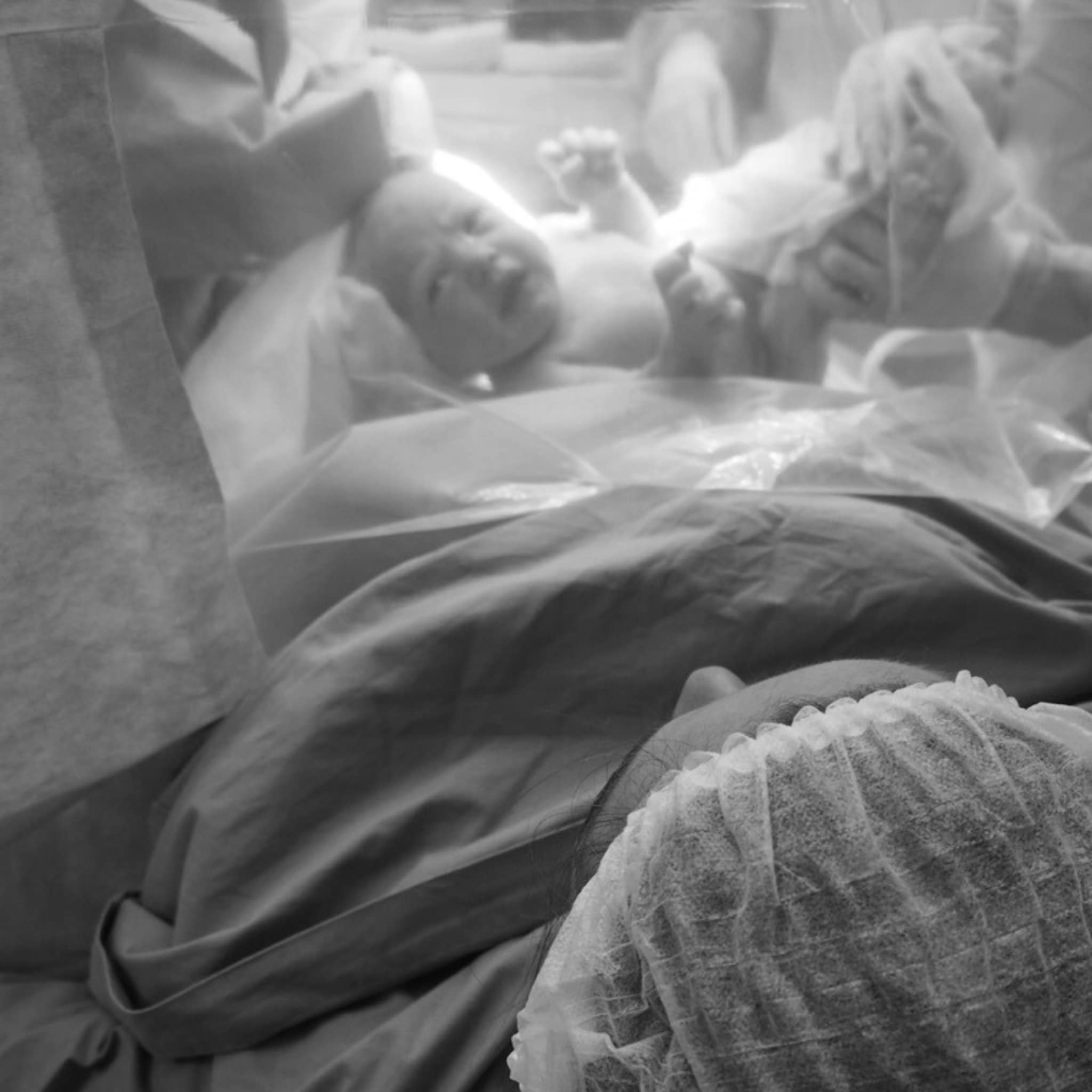 ingers bevallingsverhaal je baby ligt in stuit en we krijgen haar niet gedraaid