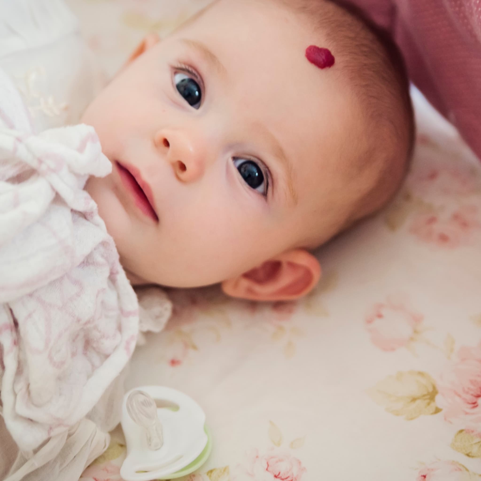 aardbeienvlek of hemangioom bij je baby wat is dat