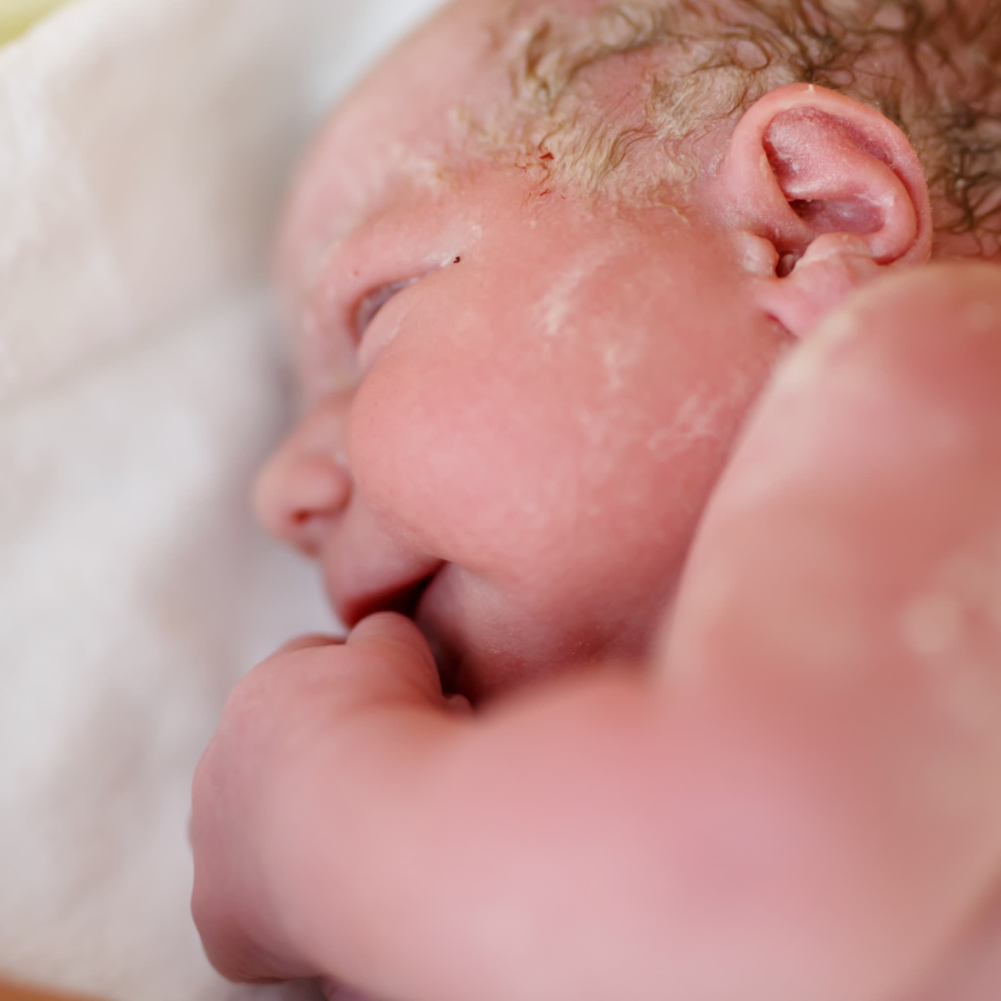vernix witte laag op de huid van een pasgeboren baby