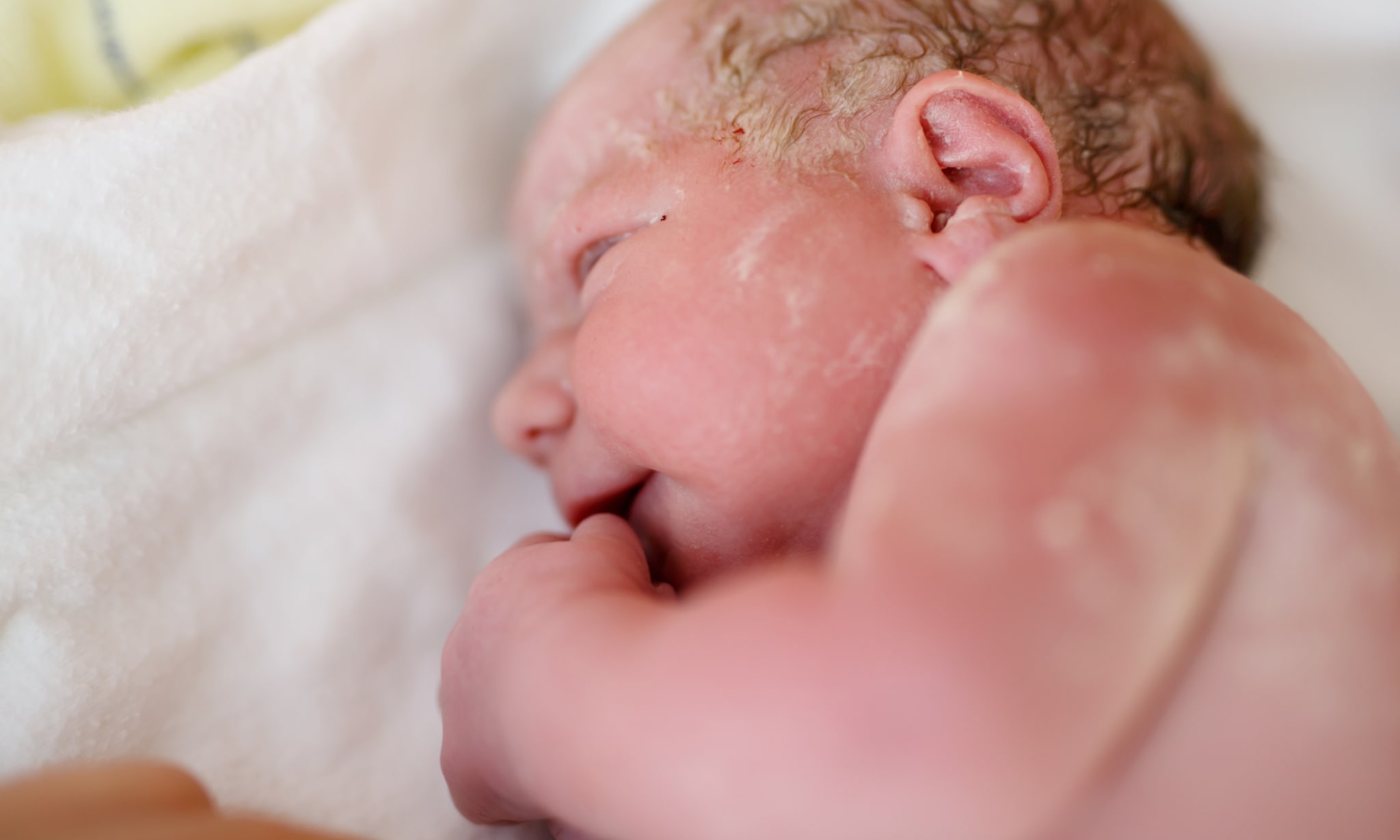 Vernix witte laag op de huid van een pasgeboren baby