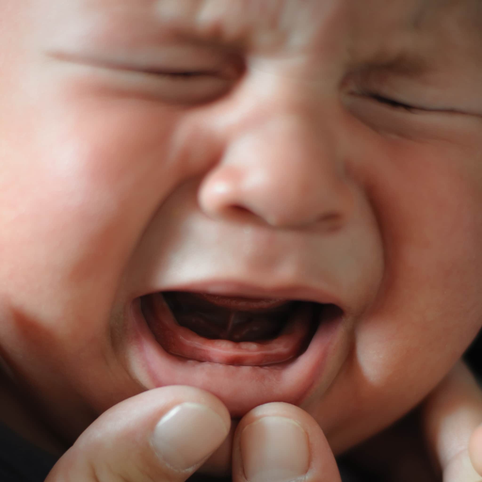 dentinox helpt dit geneesmiddel bij doorkomende tandjes