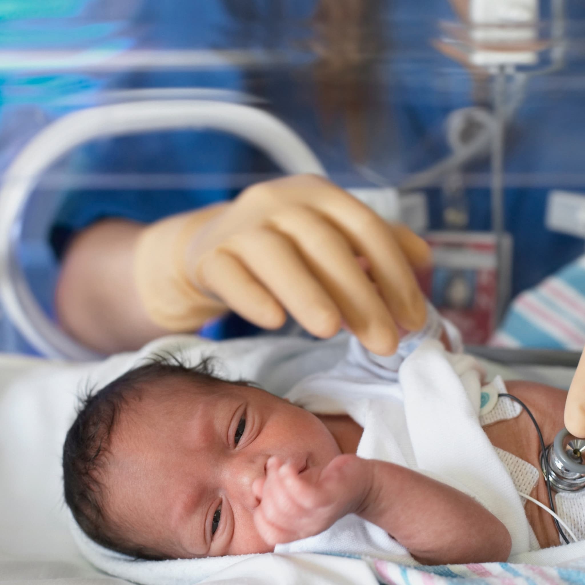 onderzoek ai pijn premature baby
