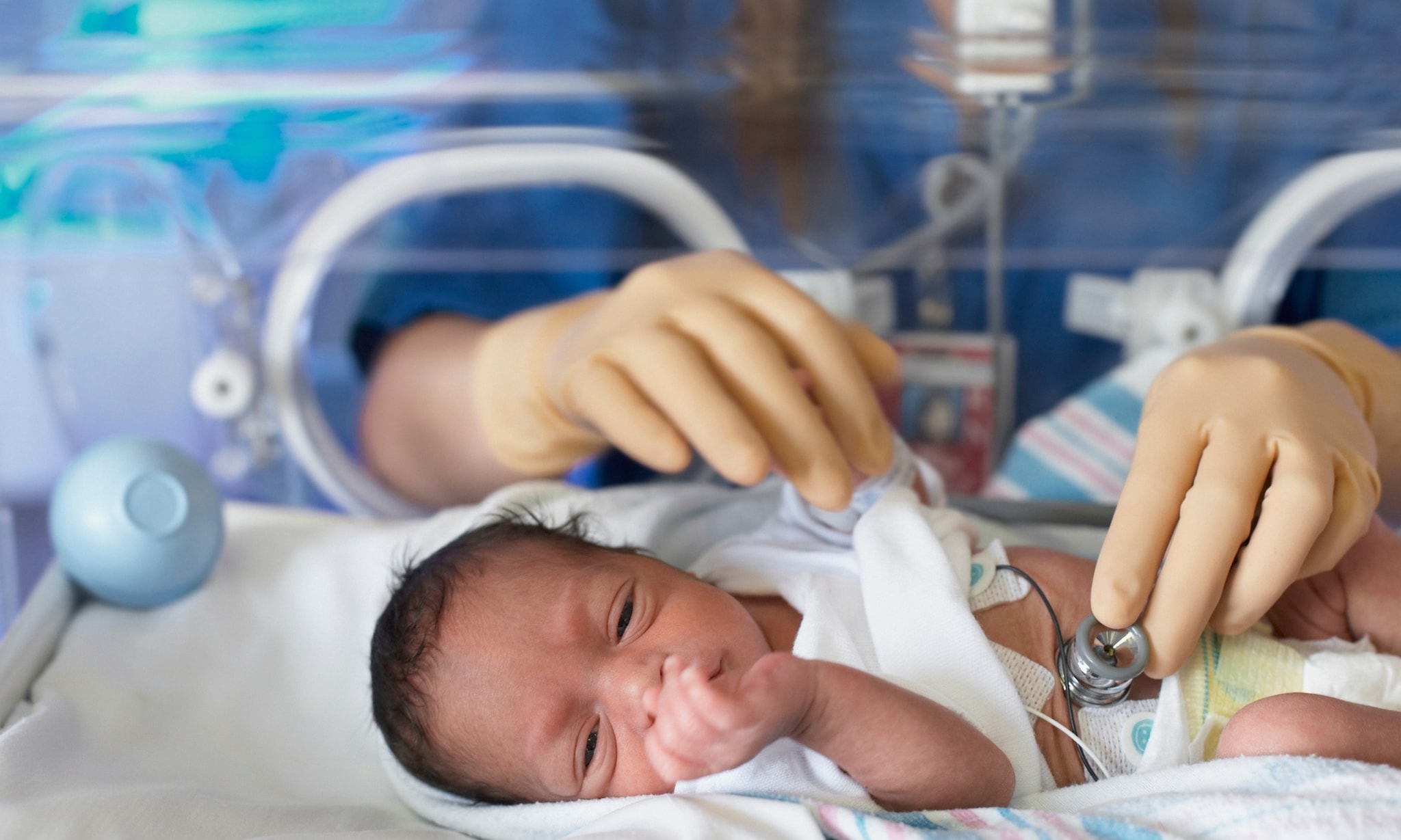 Prematuur baby Getty Images