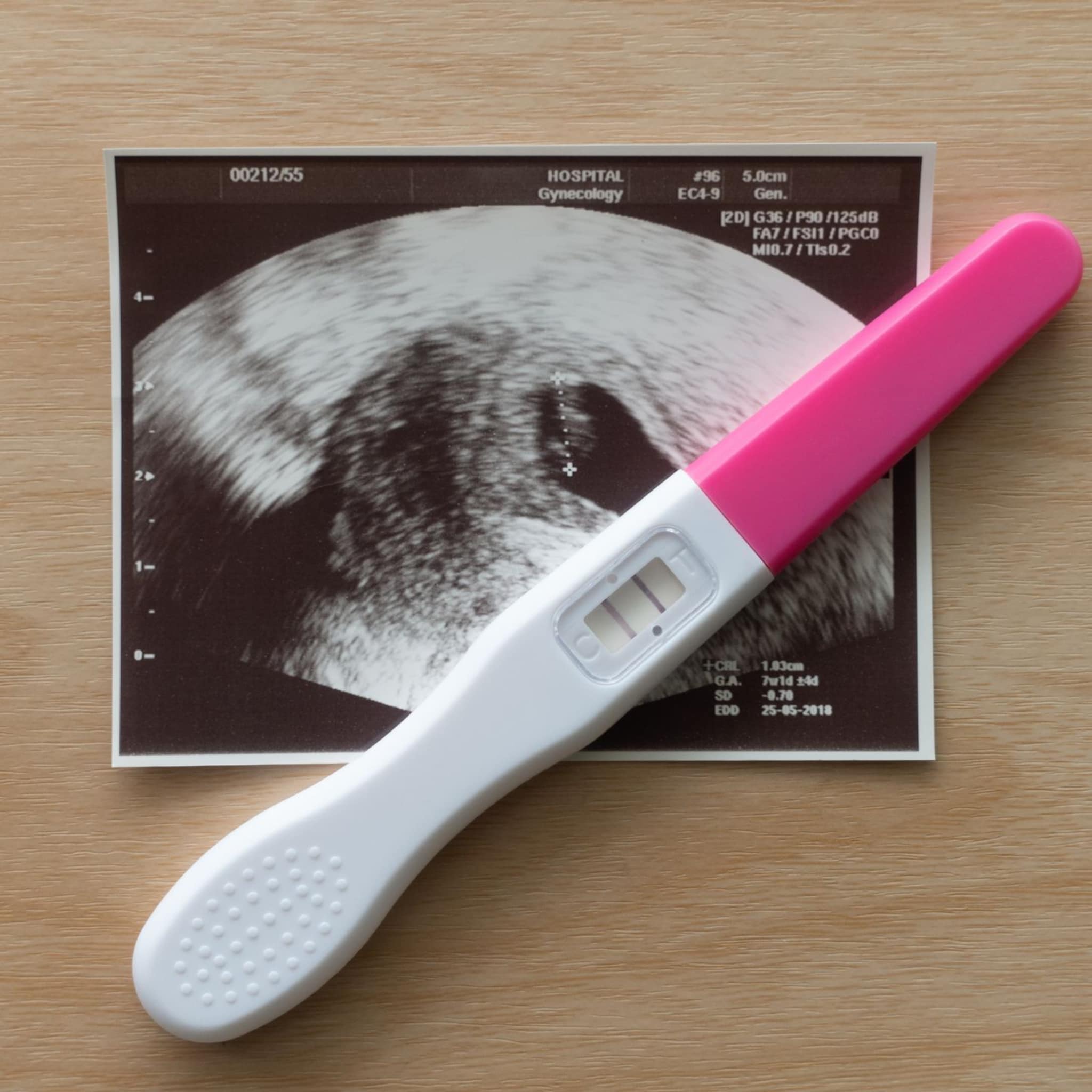 termijnecho eerste ontmoeting met je ongeboren baby