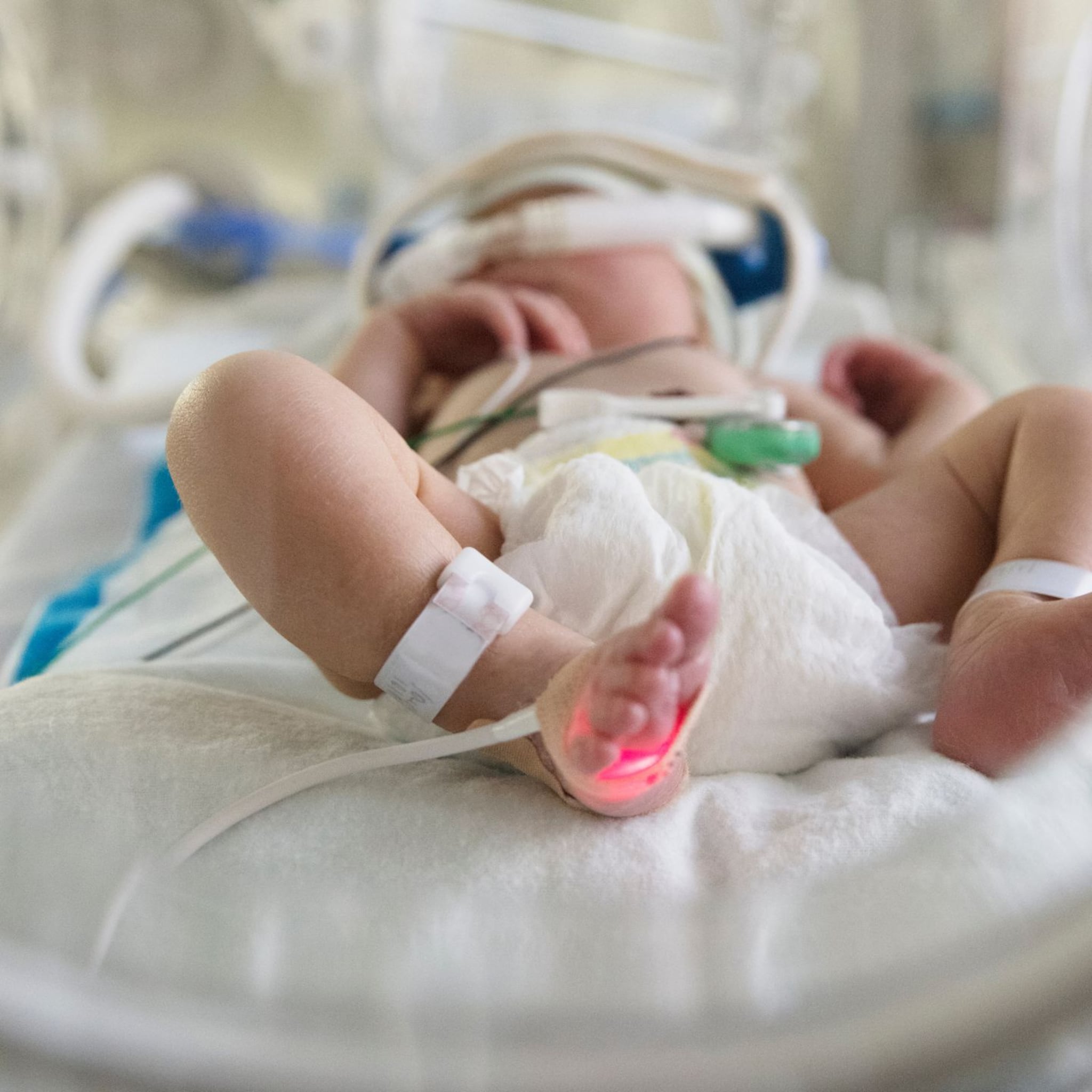 de afdeling neonatologie dit kun je verwachten