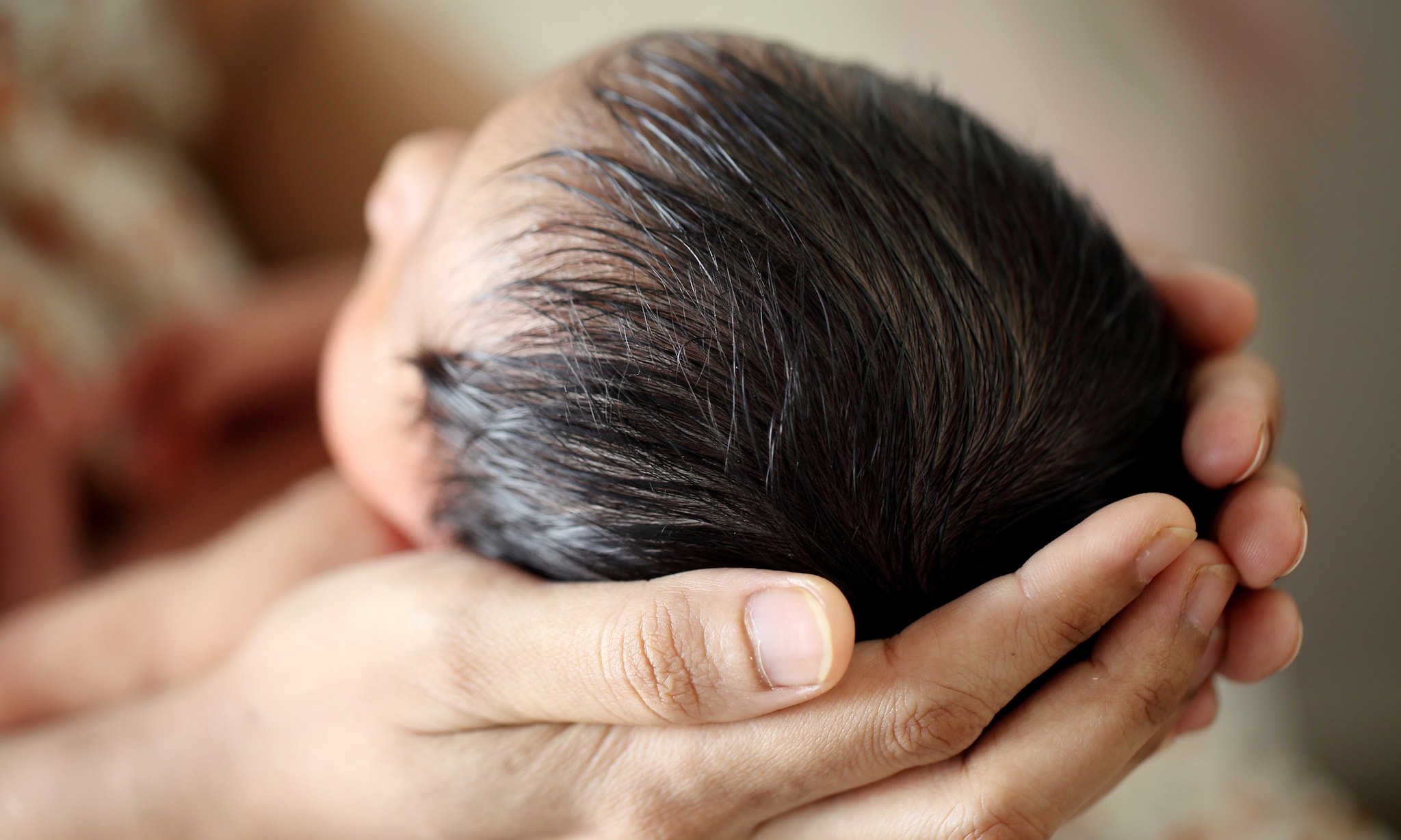 Afgeplat hoofd baby Getty Images