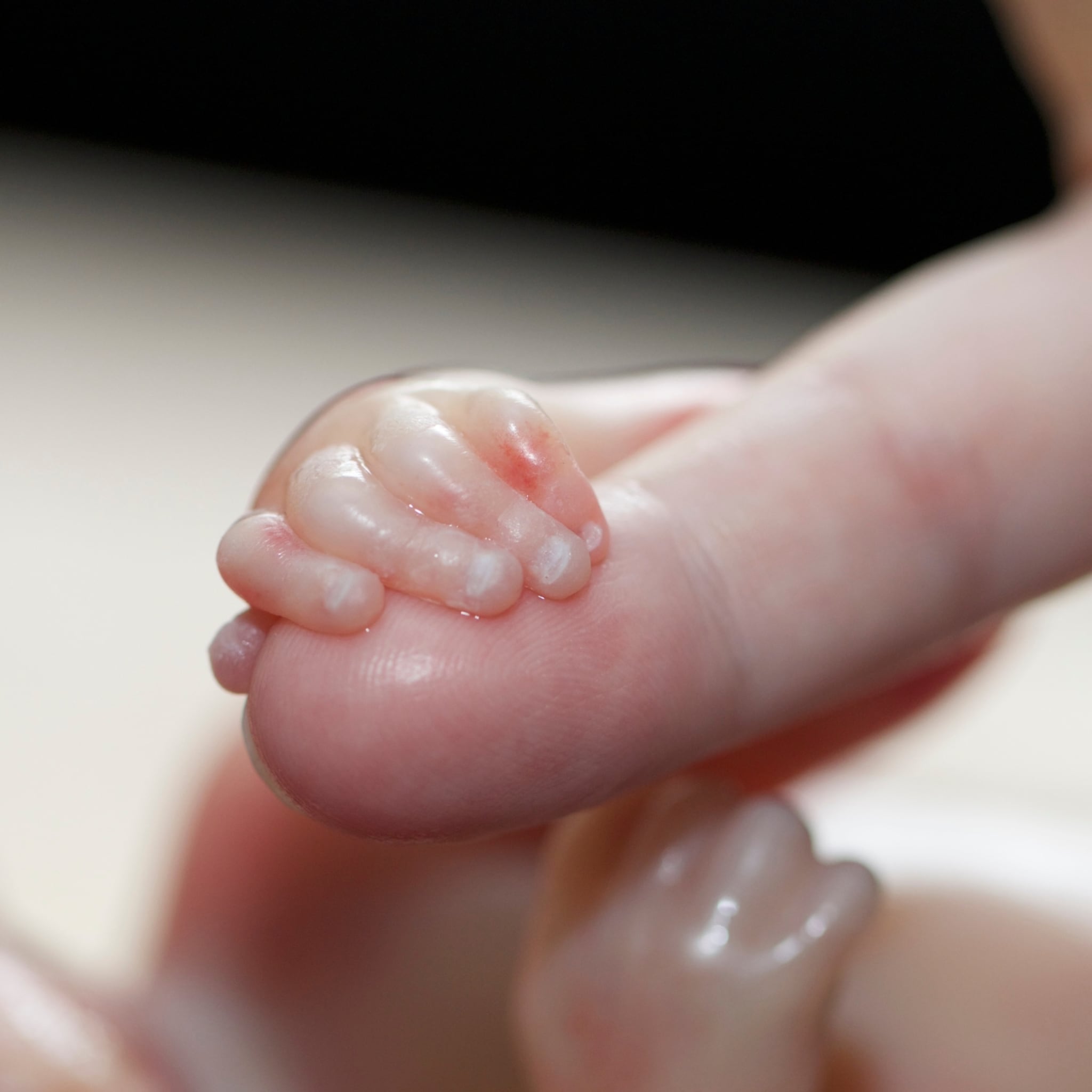 marjorie overleden baby watermethode