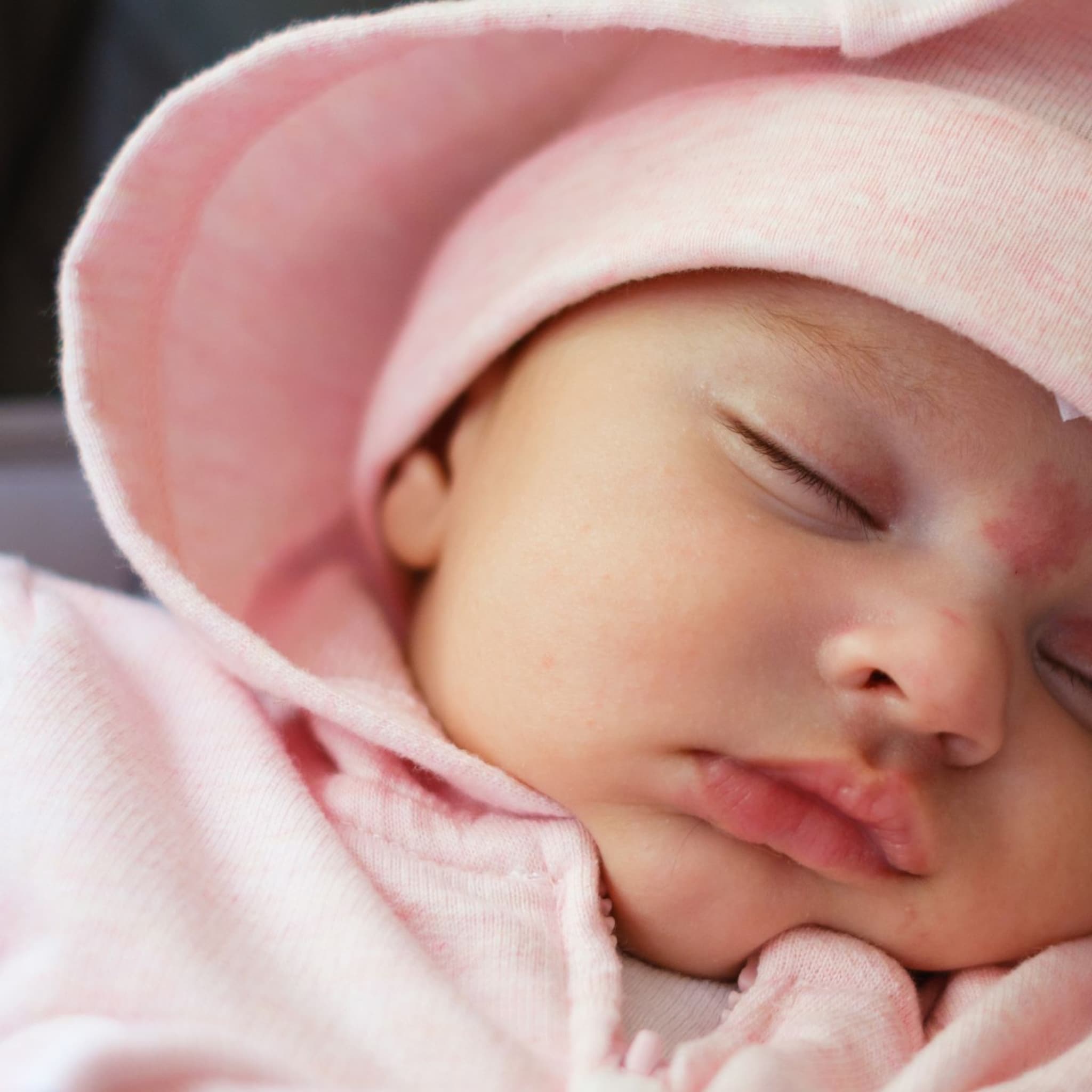 geboortevlekken bij baby s
