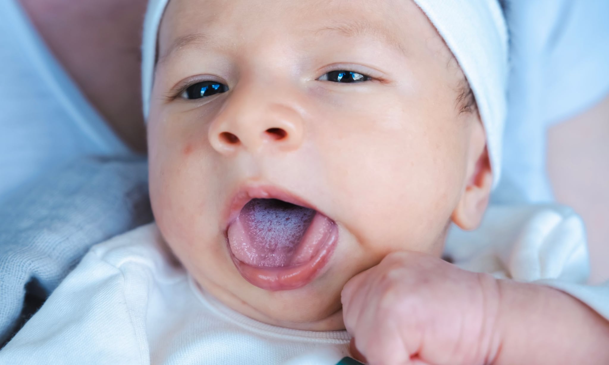 Spruw baby Getty Images