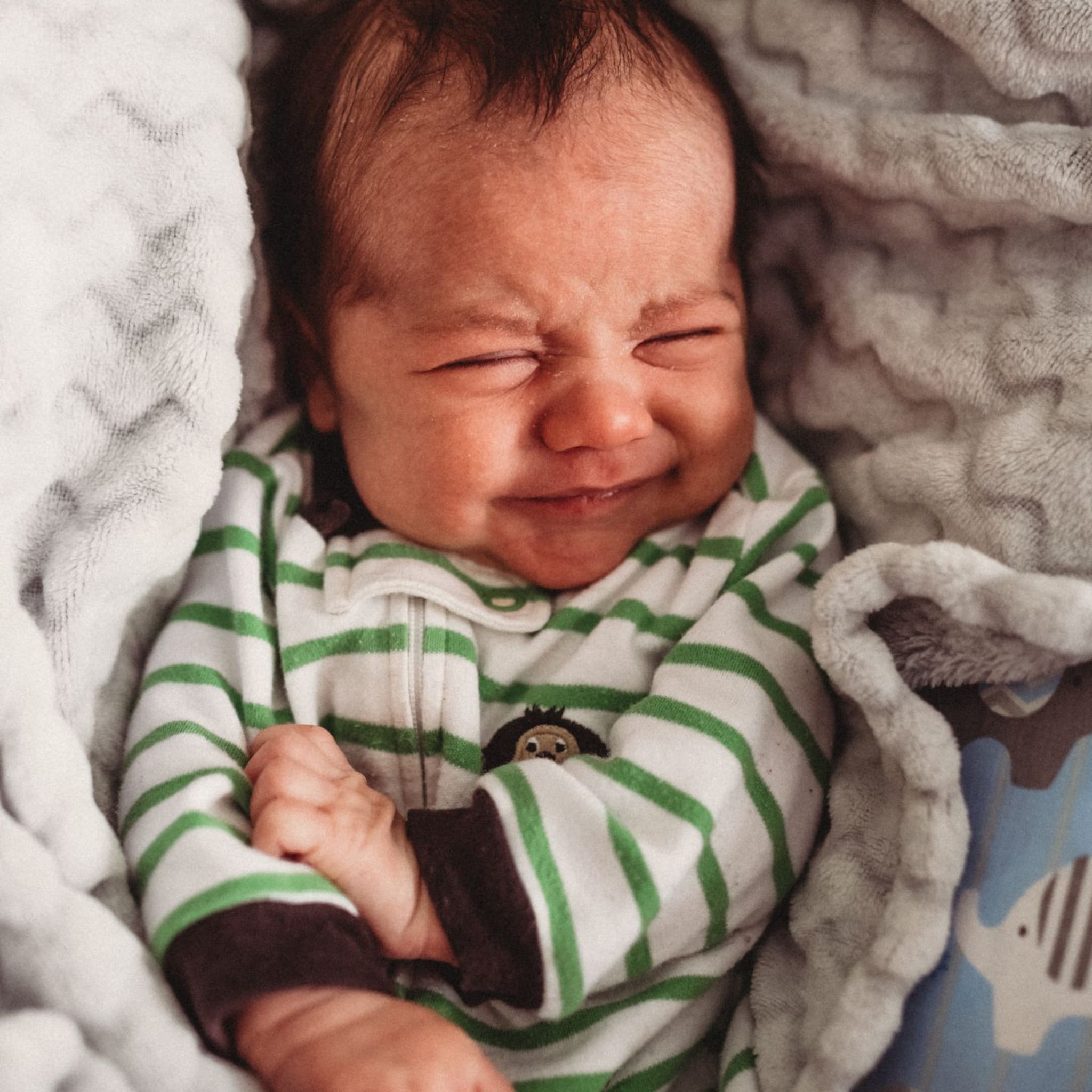waterhoofd bij je baby