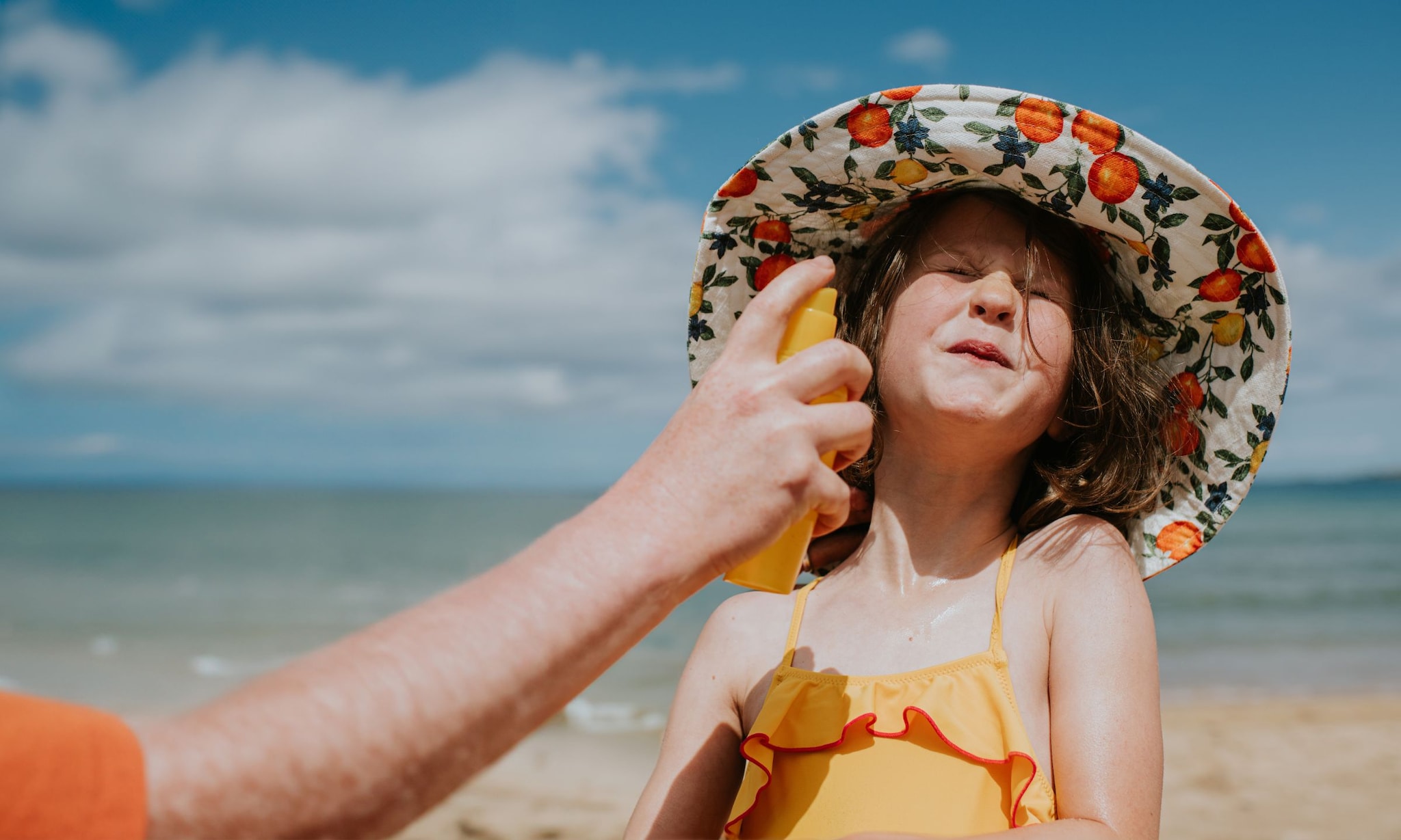 Kind verbrand door de zon Getty Images