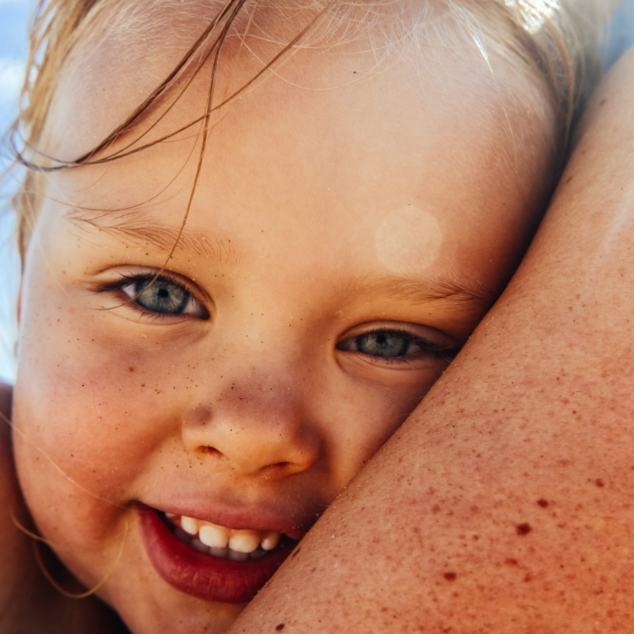 zonneallergie bij baby s en kinderen