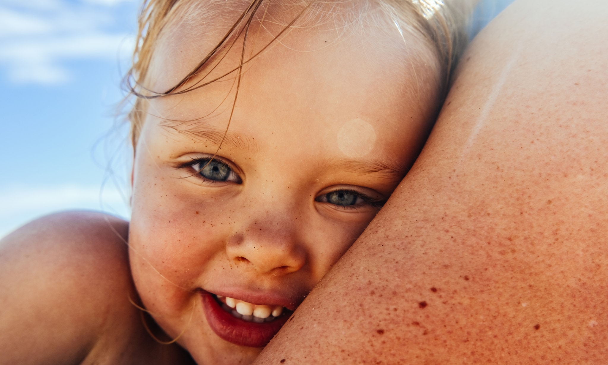 Zonneallergie bij baby’s en kinderen Getty Images
