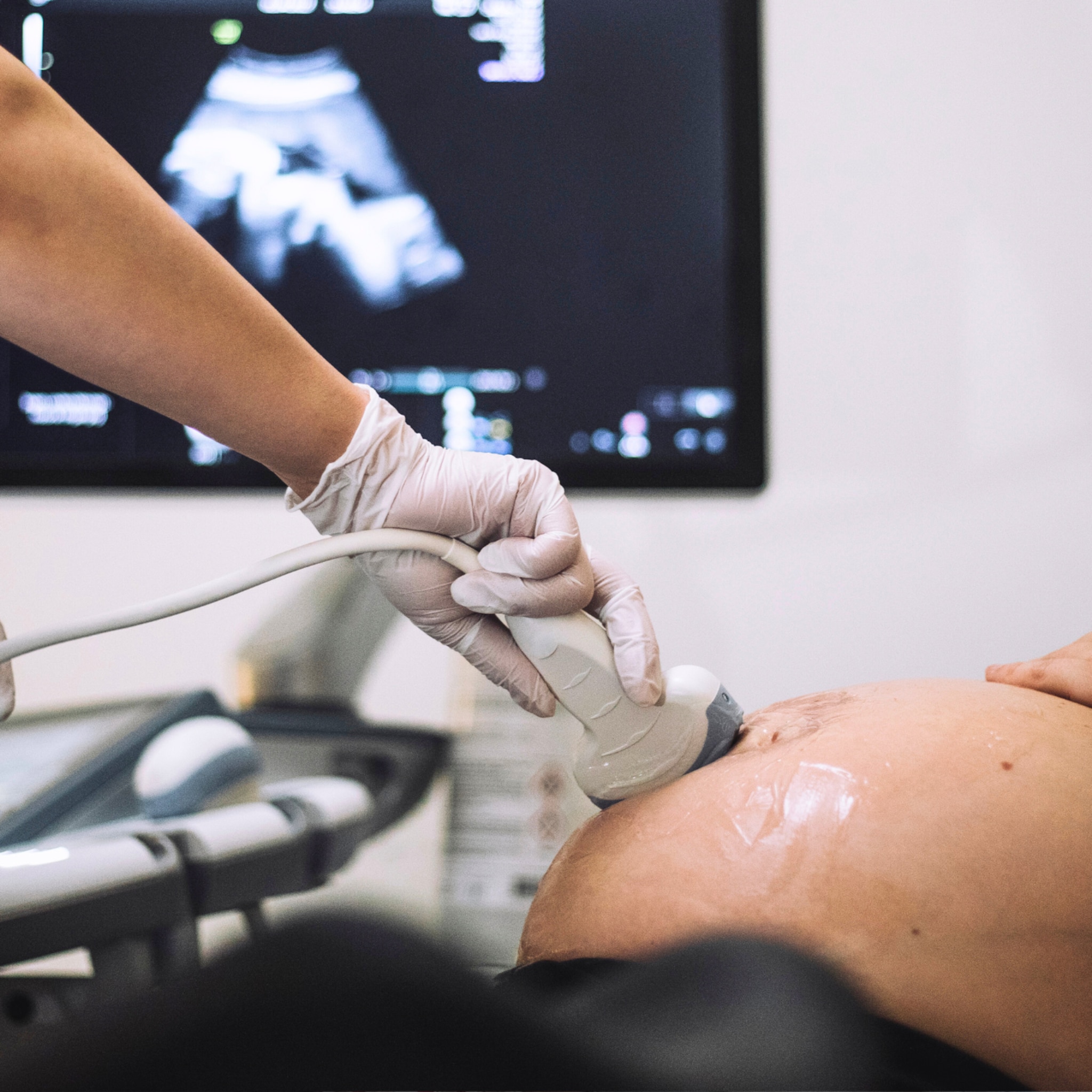 prenatale screening hierop wordt je baby onderzocht