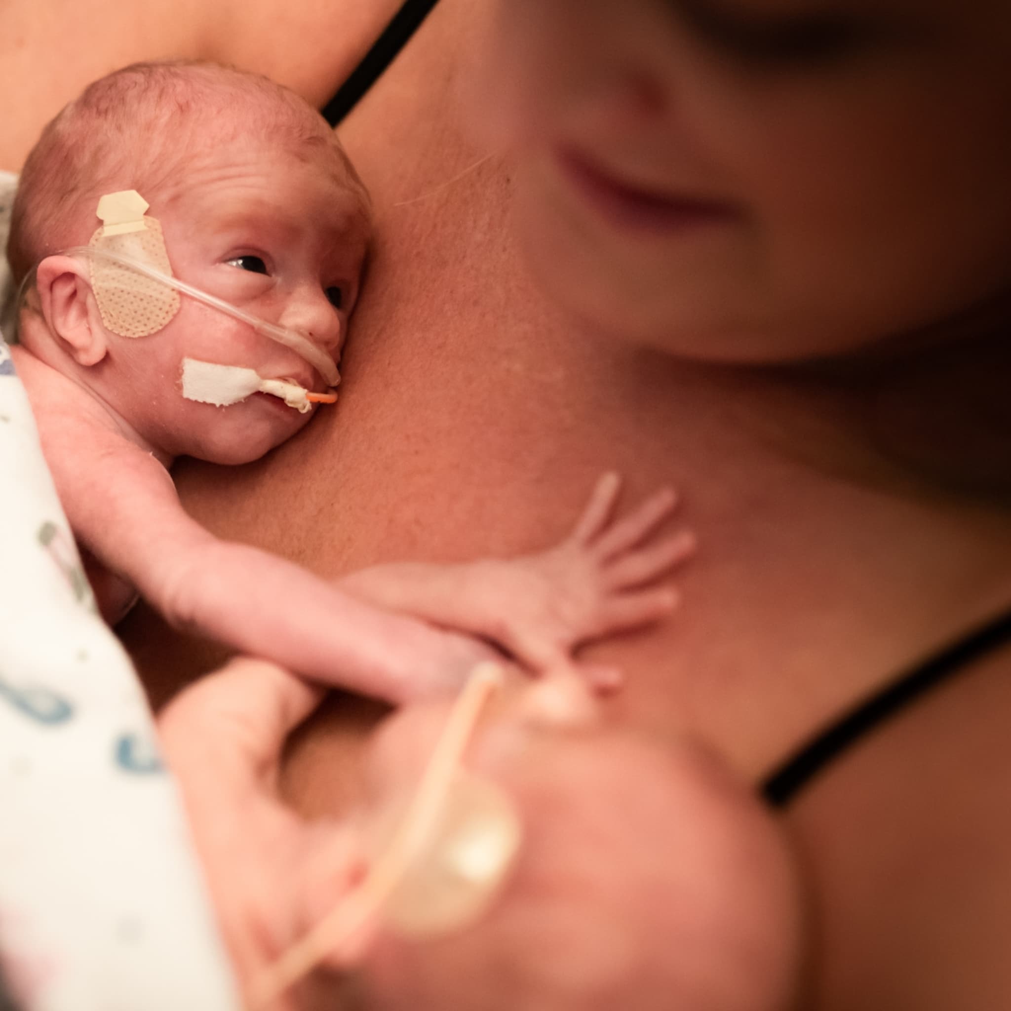 onderzoek neonatologie buidelen couveusebaby