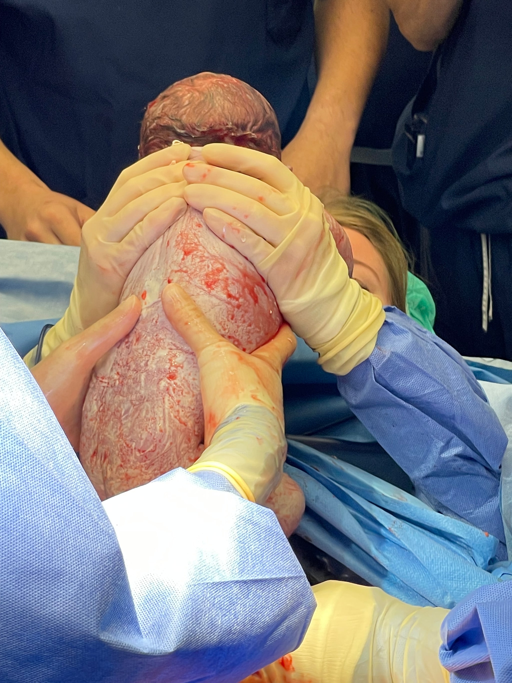 Andrea Dijkshoorn heeft zojuist haar dochtertje uit haar buik getild Eigen foto