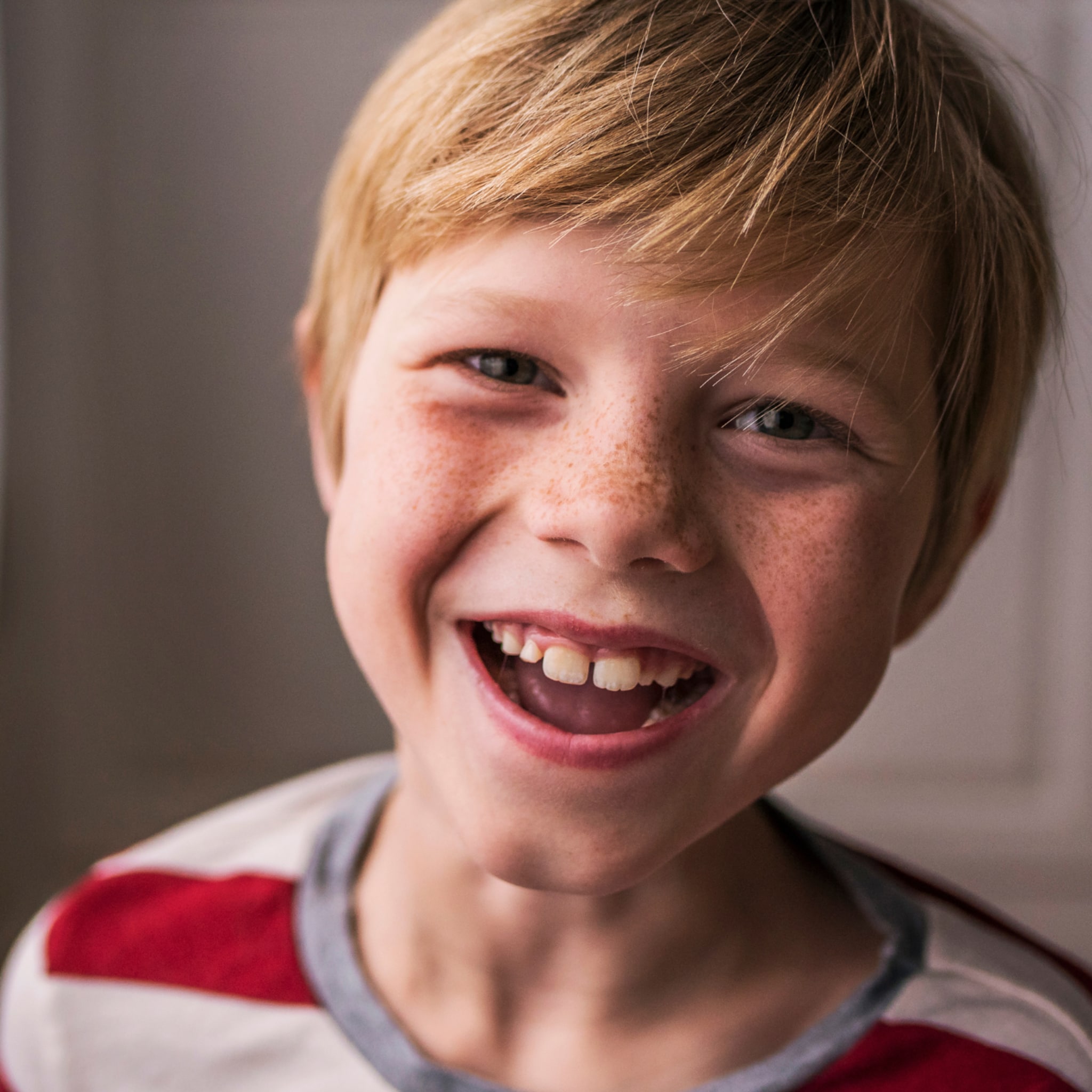 oogafwijkingen bij kinderen