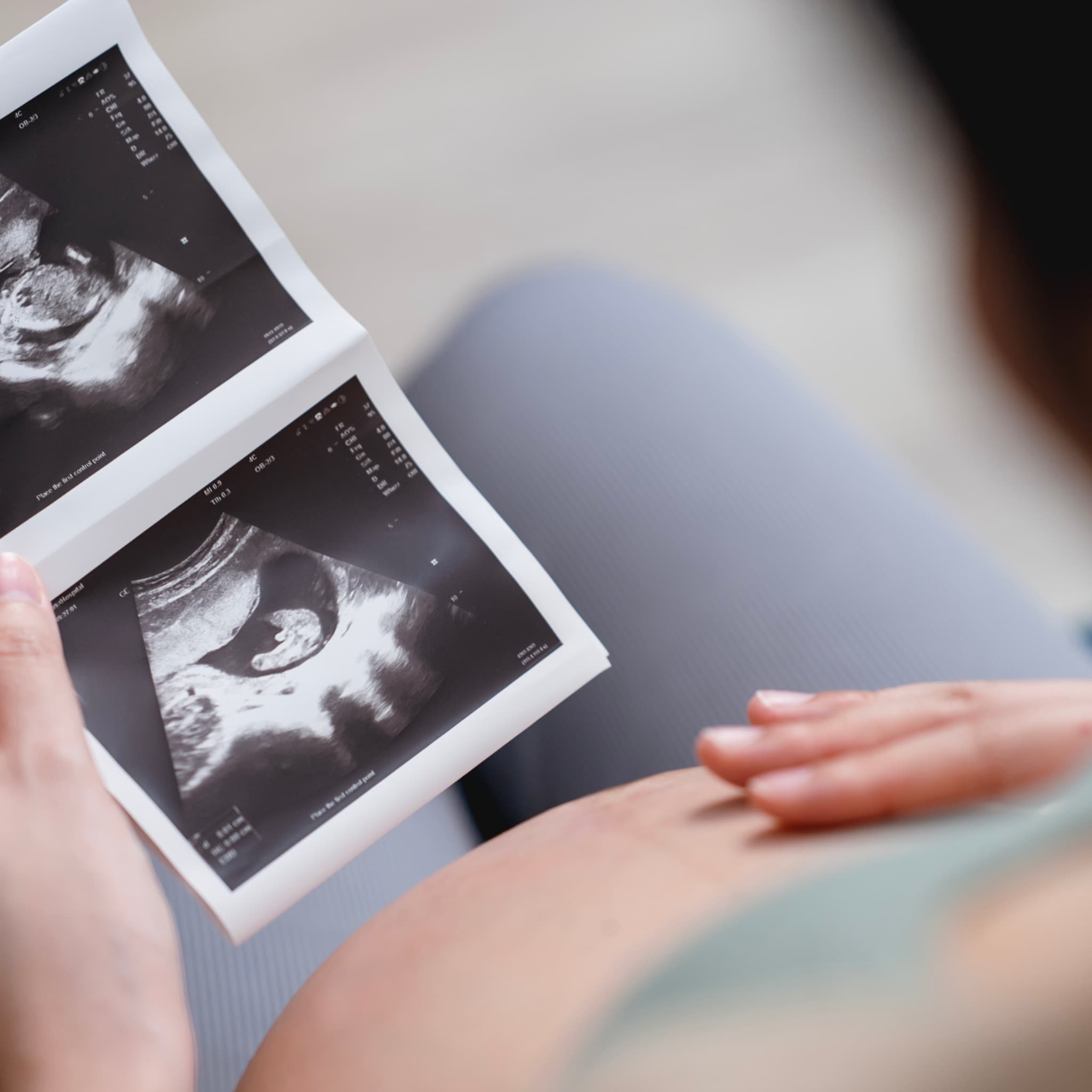 de placenta moederkoek wat is haar functie