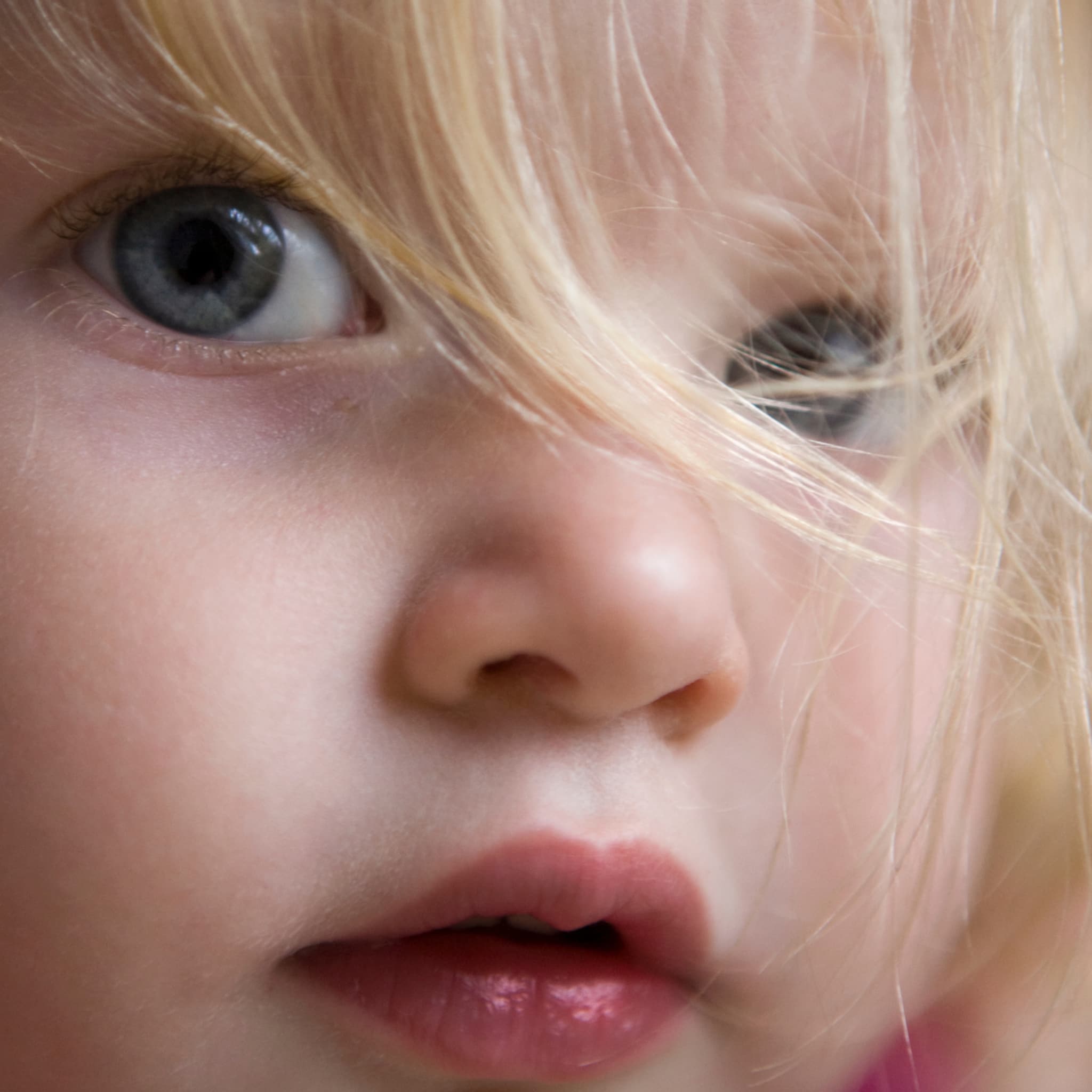 alk bij kind wat houdt dit in en wat kun je doen