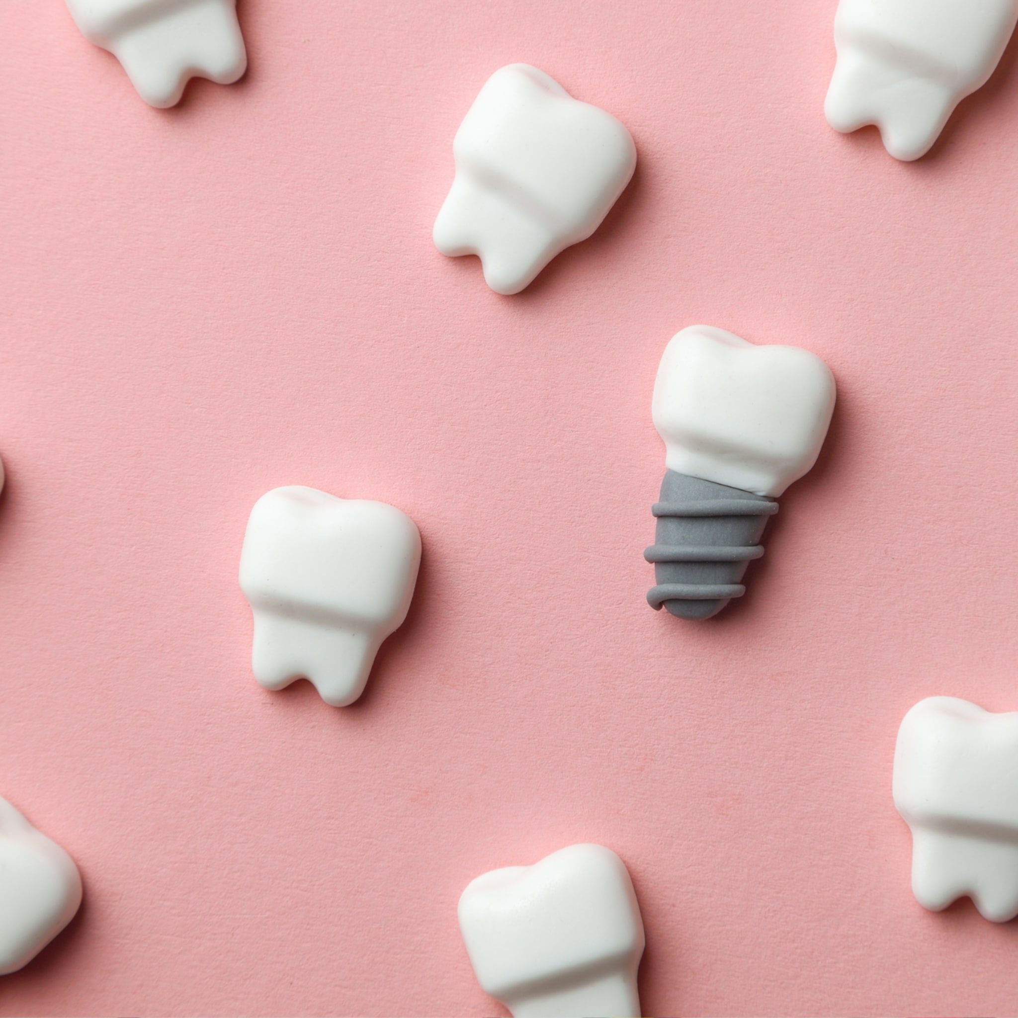 zwanger en naar de tandarts hoe zit dit