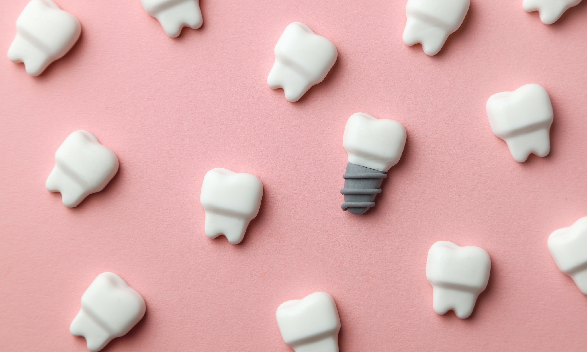 Zwanger en naar de tandarts hoe zit dit Getty Images