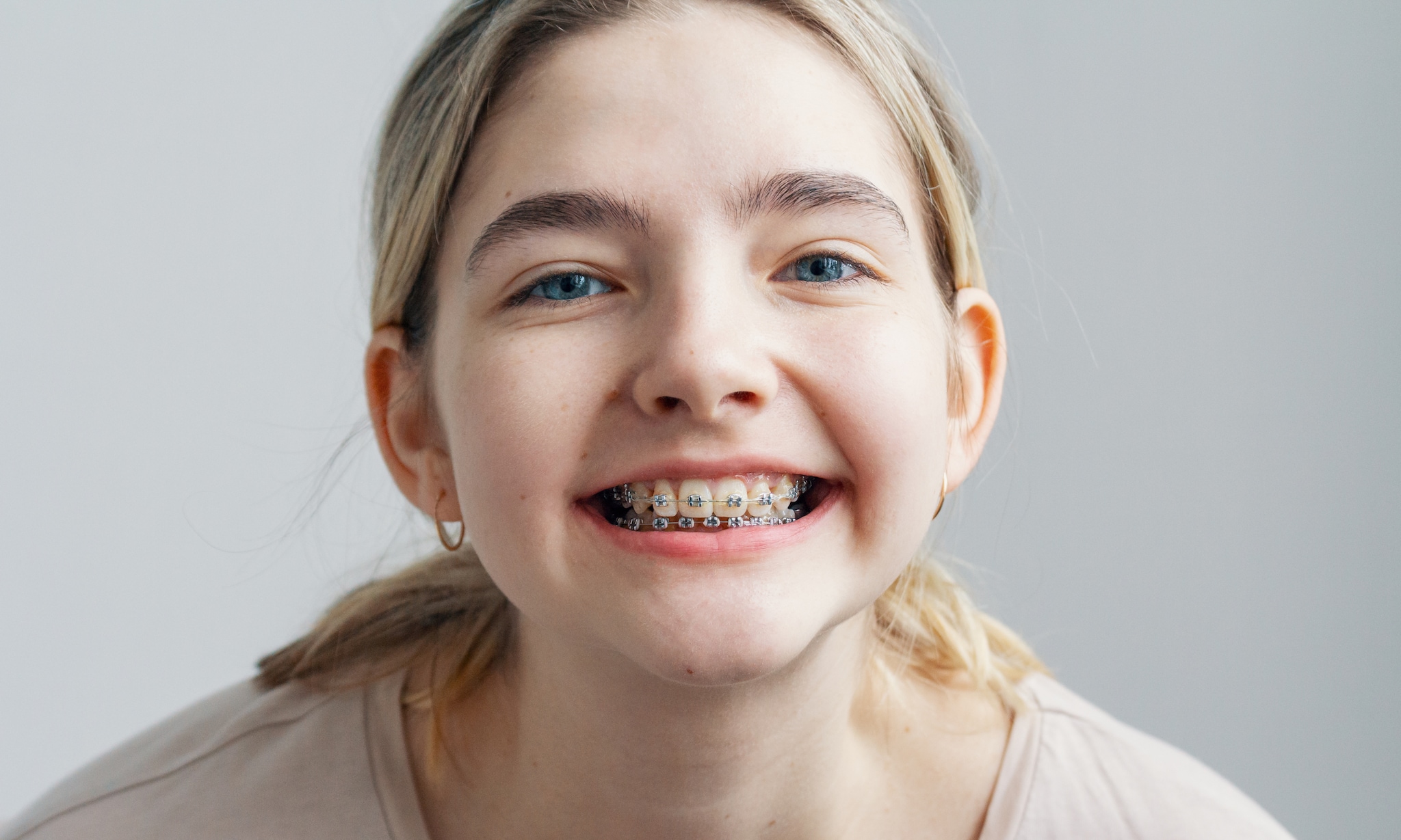 Wat kost een beugel voor je kind Getty Images