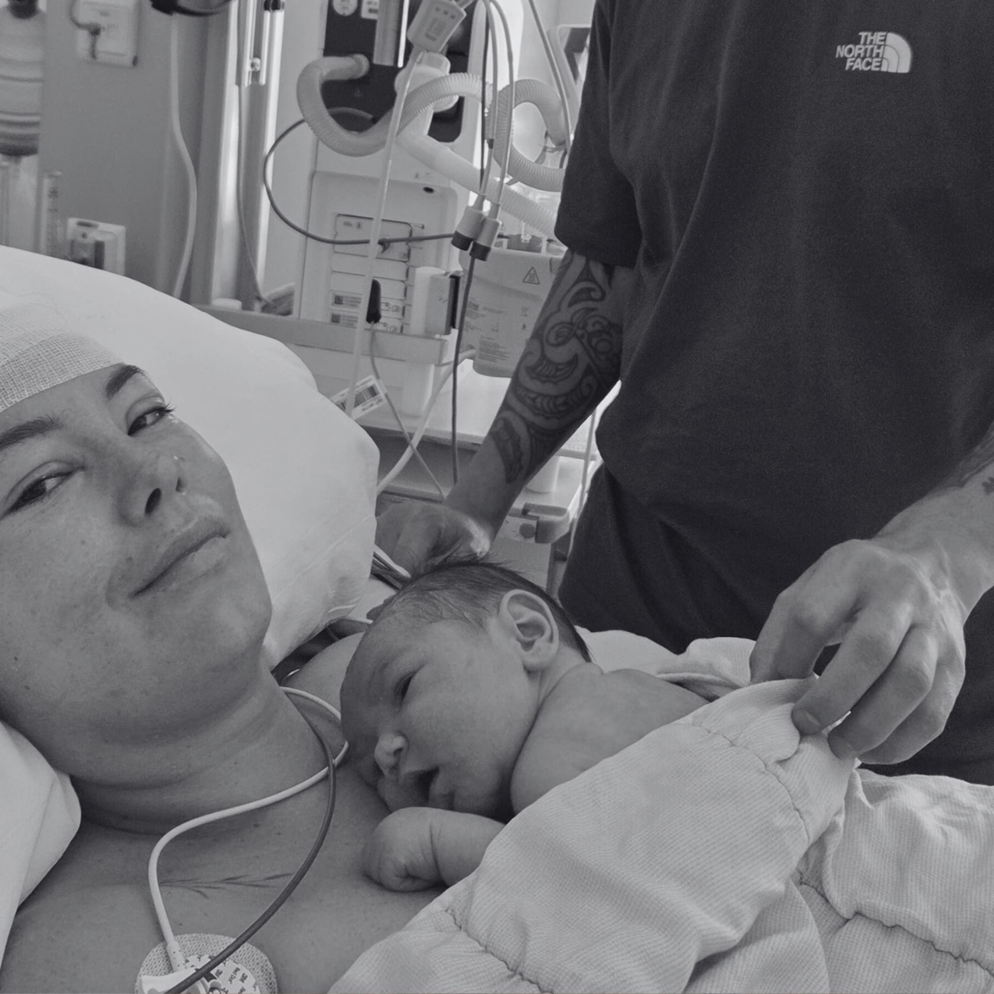 bevallingsverhaal romy hersentumor