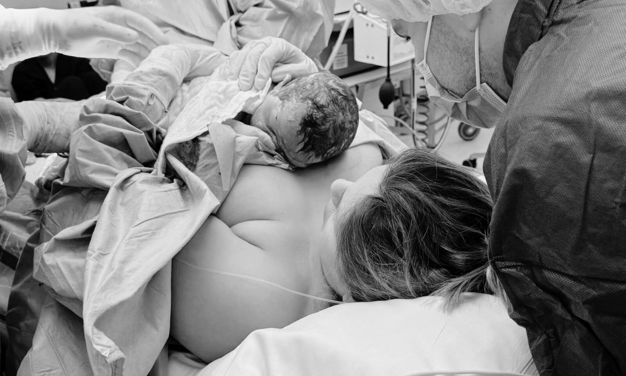 Michelle (33) vertelt over haar moeder-geassisteerde keizersnede (MAC) Privé