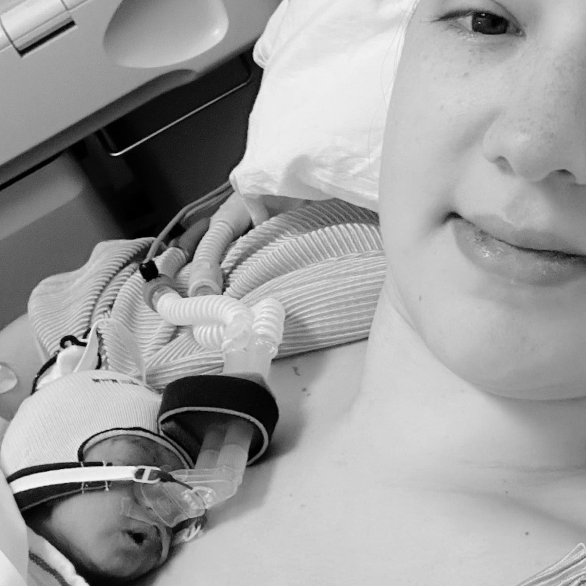 bevallingsverhaal sabrina keizersnede na hellp syndroom